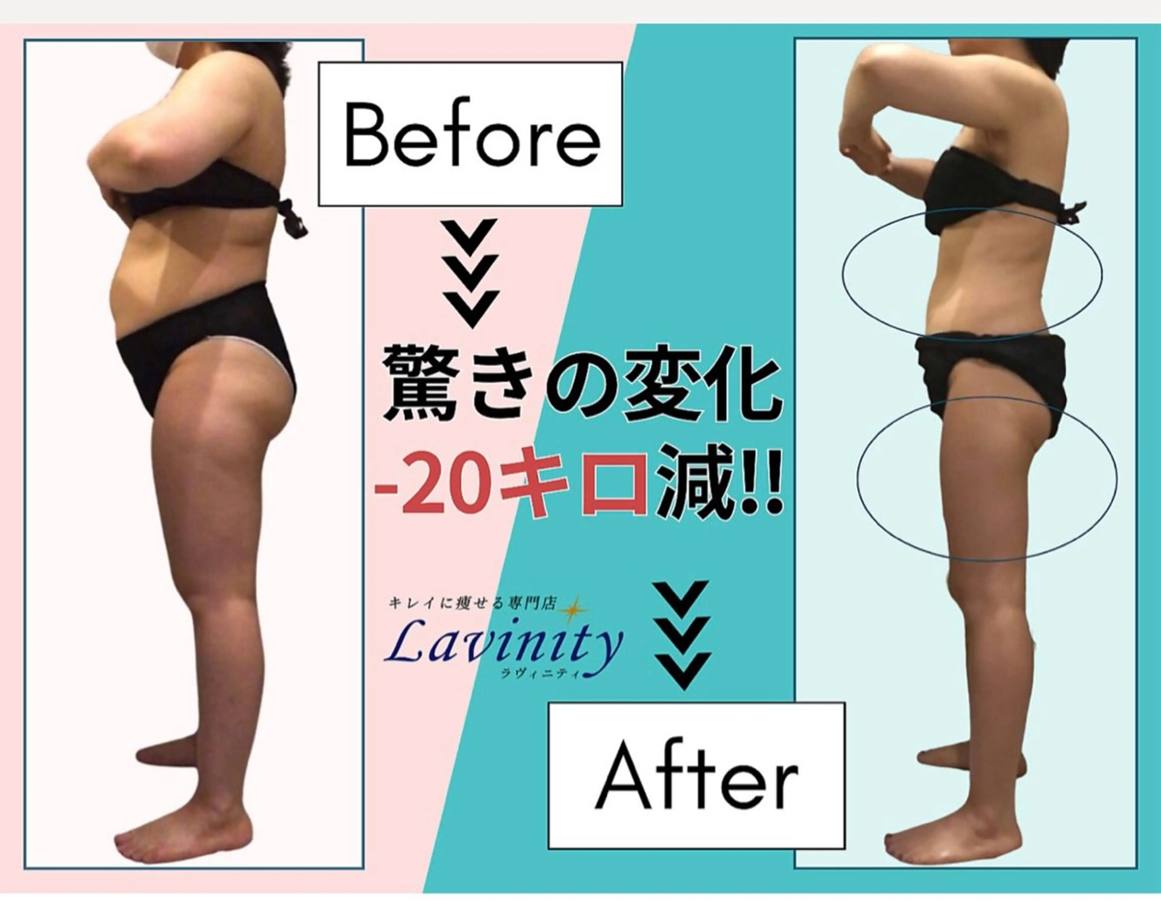 体重以上に見た目が変わる★ダイエットプログラム+セル脂肪痩身フル体験115分の写真