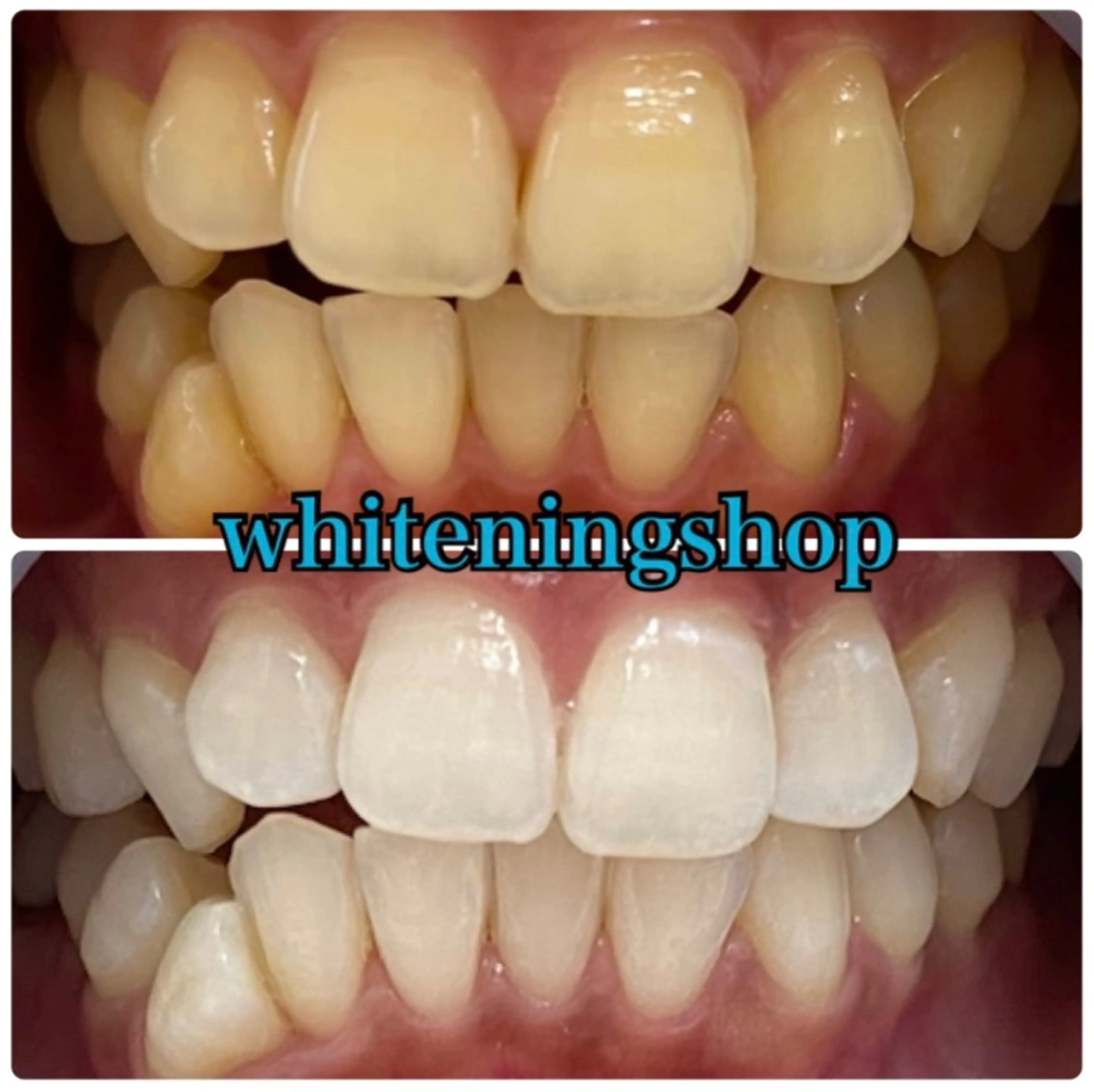 エステ リラク ホワイトニング ショップ吉祥寺店のエステ・リラクイメージ