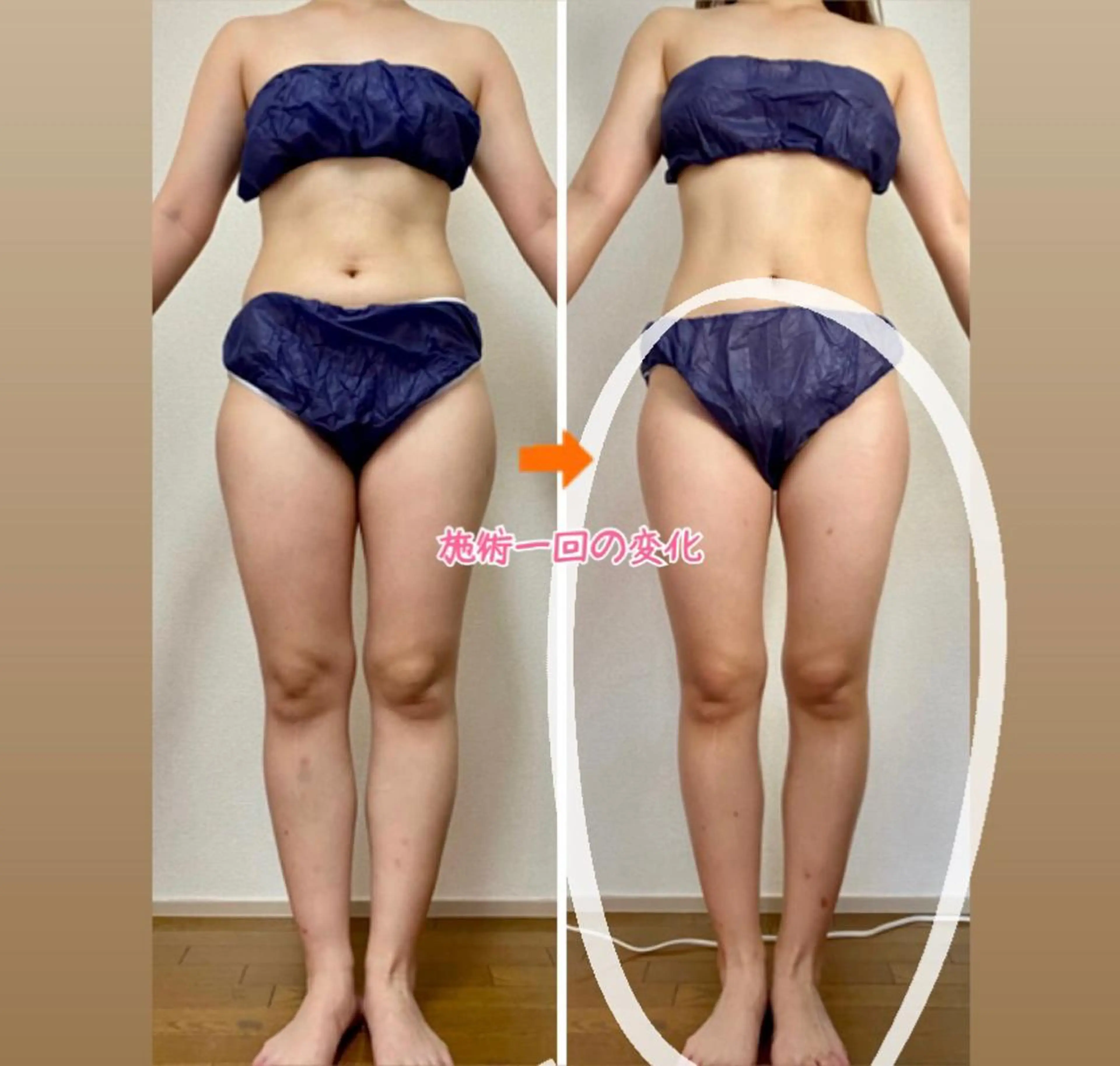 ショート カラー パーマ ヘアアレンジ メンズ キッズ ネイル マツエク・マツパ マットネイル エステ リラク ‍痩身＆ボディ 結果出し🌟丹野のエステ・リラクイメージ