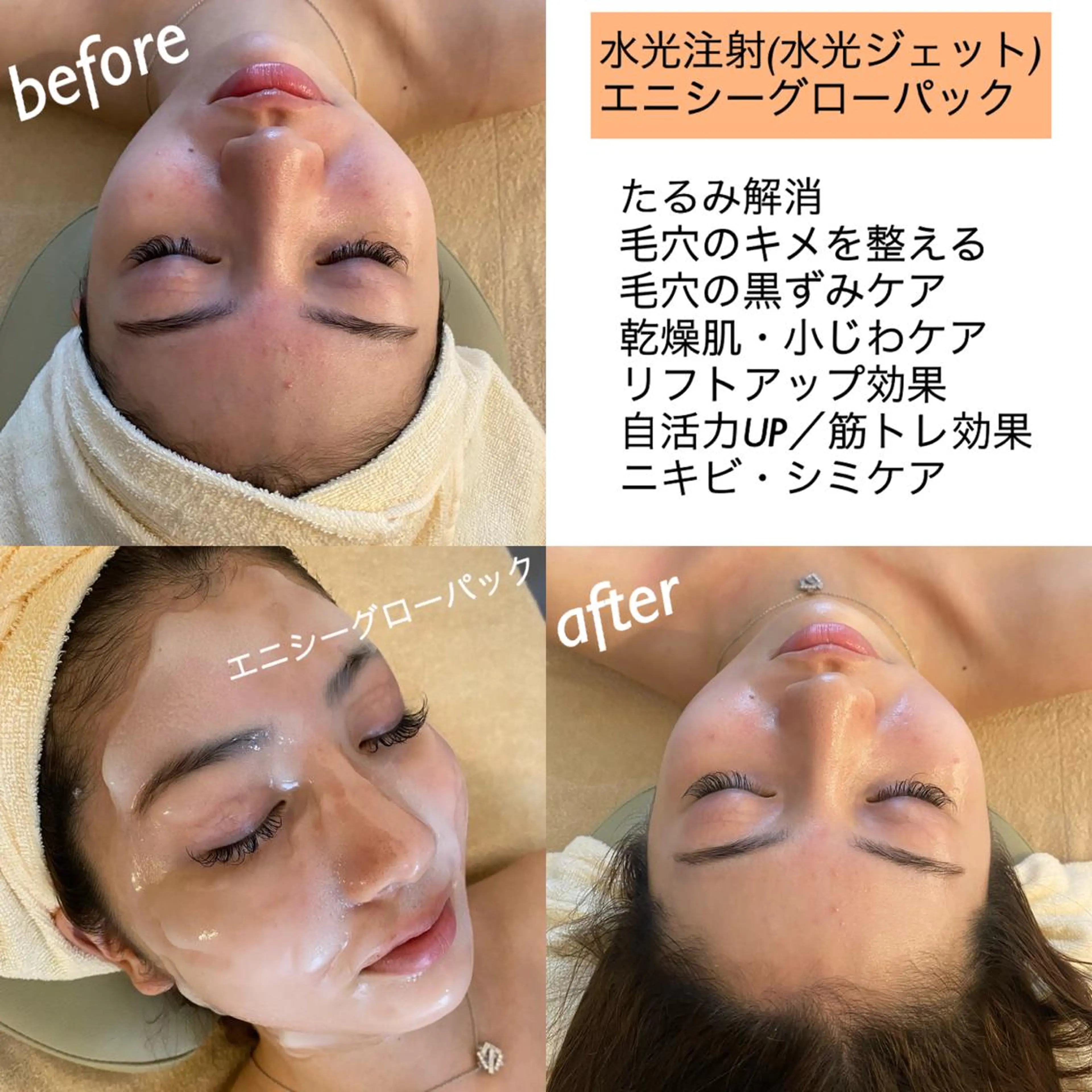 うなじ脱毛/美肌脱毛 LABELのエステ・リラクイメージ