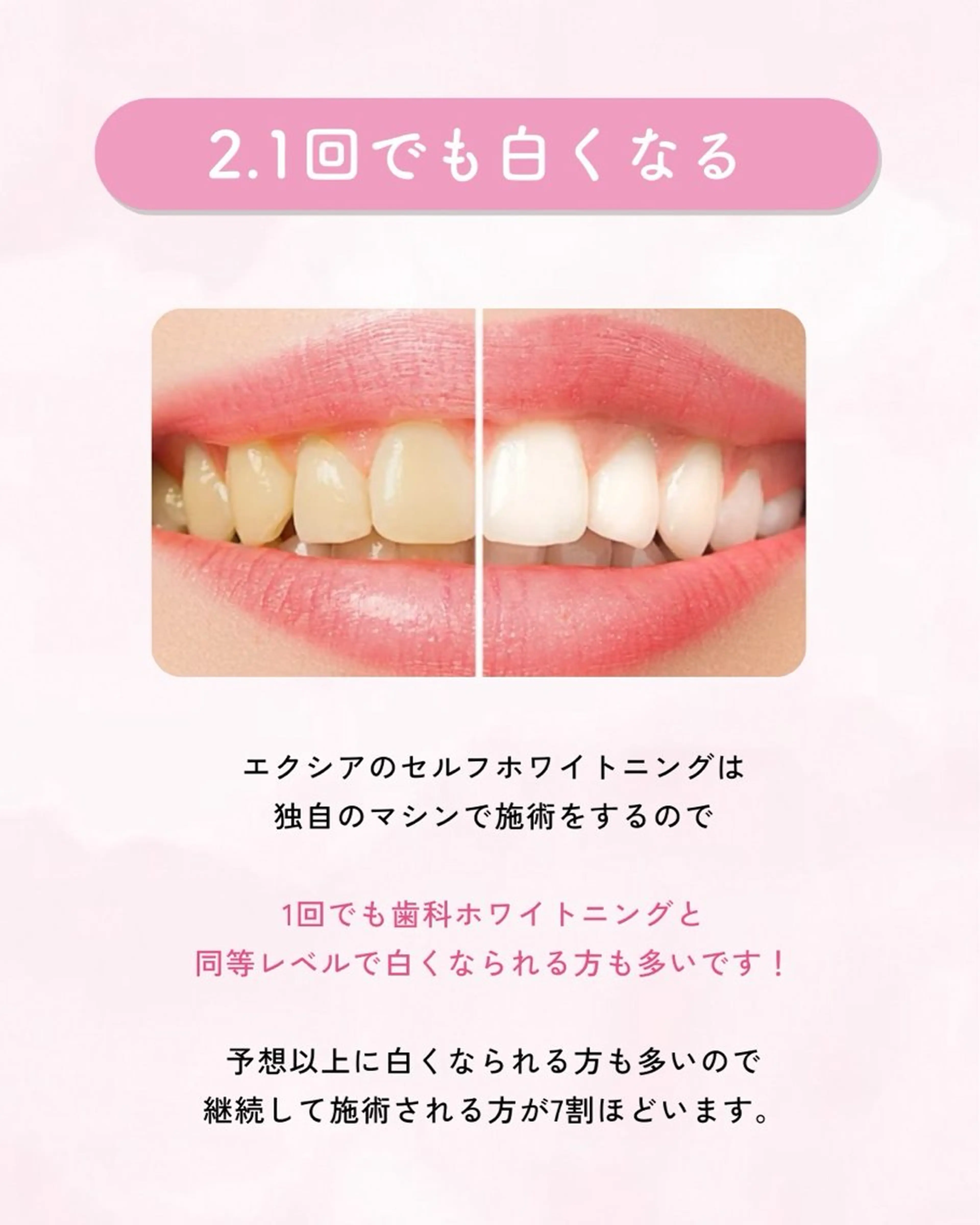 セルフホワイトニング エクシア大曽根店のその他イメージ