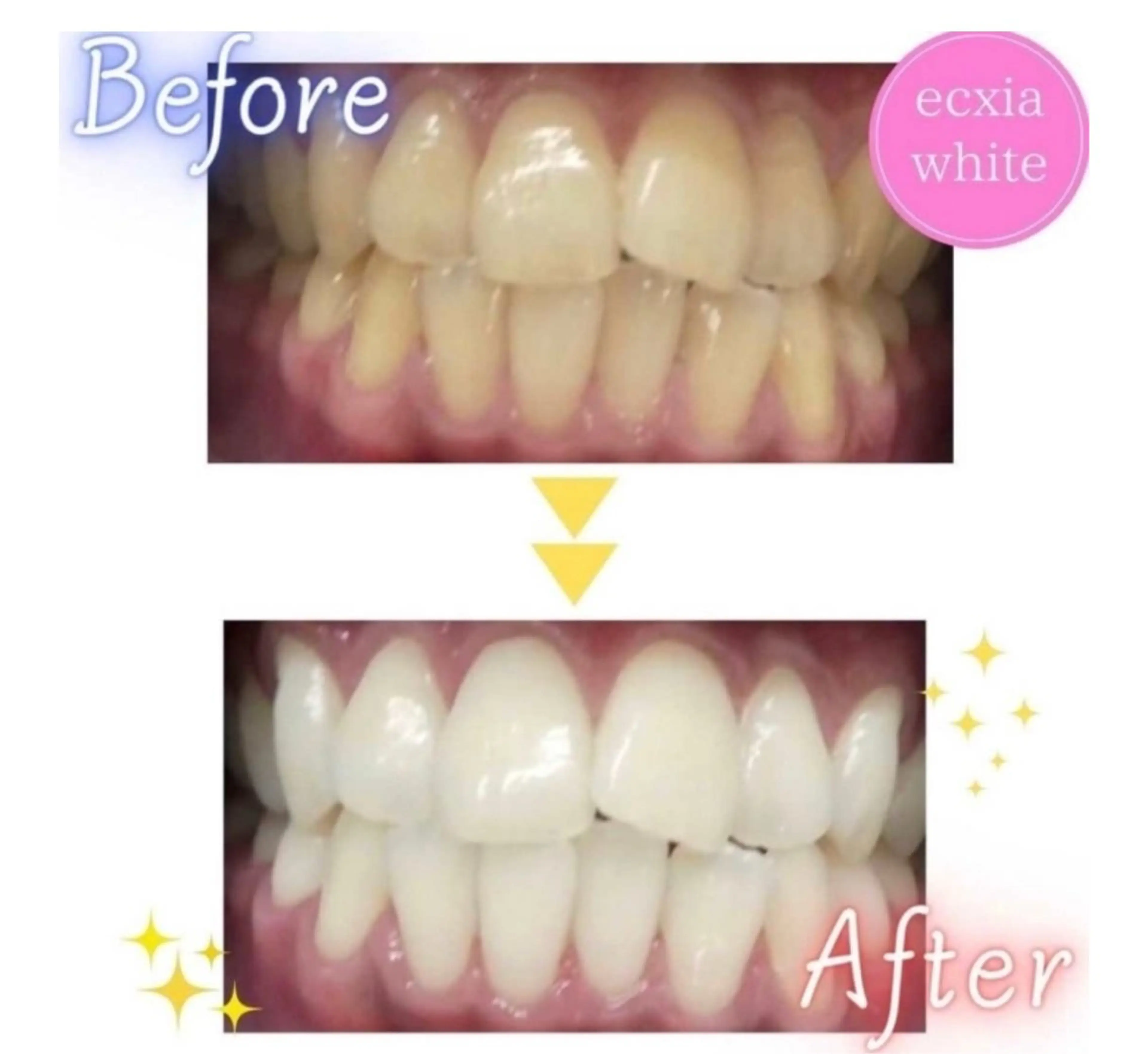ecxia  white 　広島袋町店所属・セルフホワイトニング エクシア広島袋町店のその他イメージ