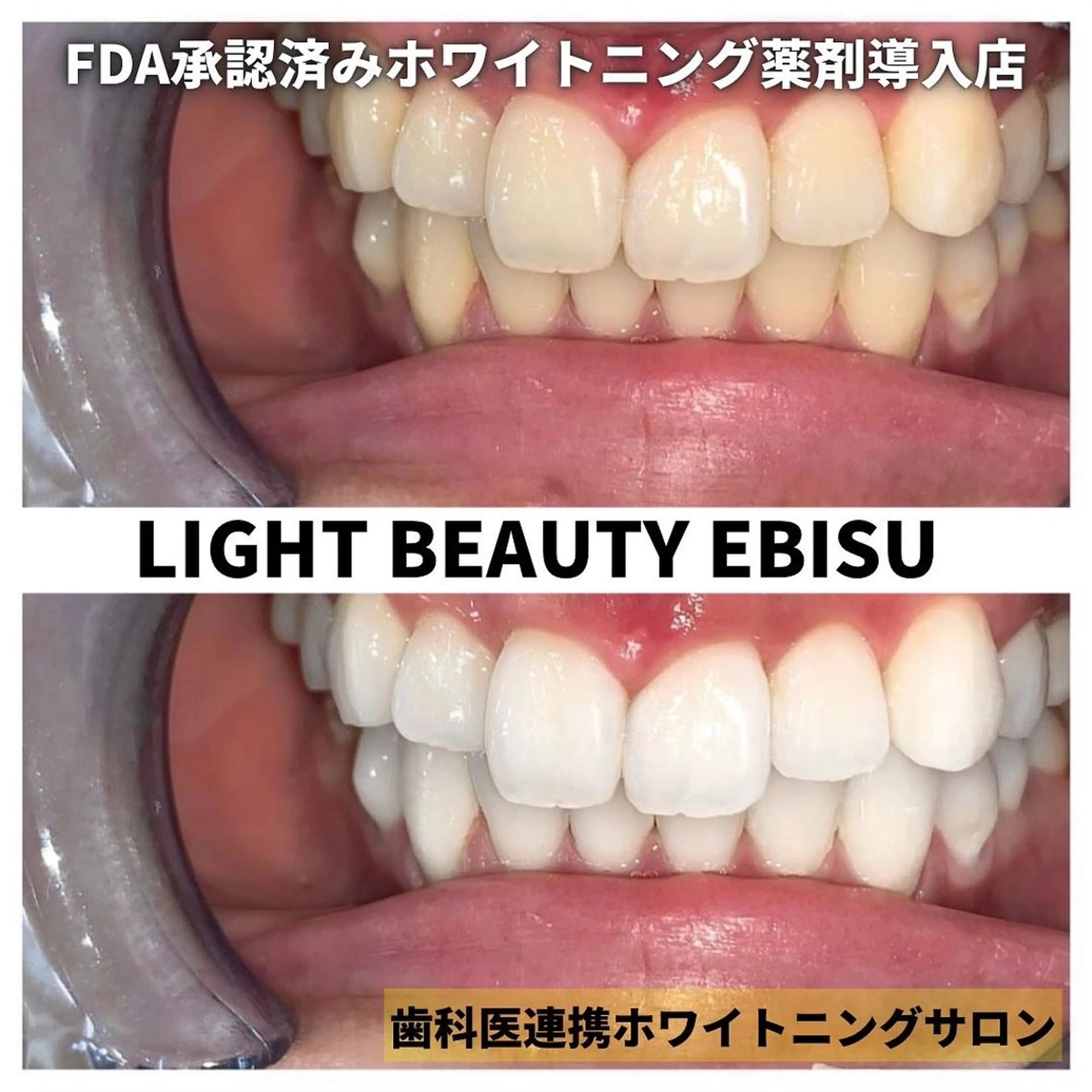 ライトビューティー 恵比寿店のその他イメージ