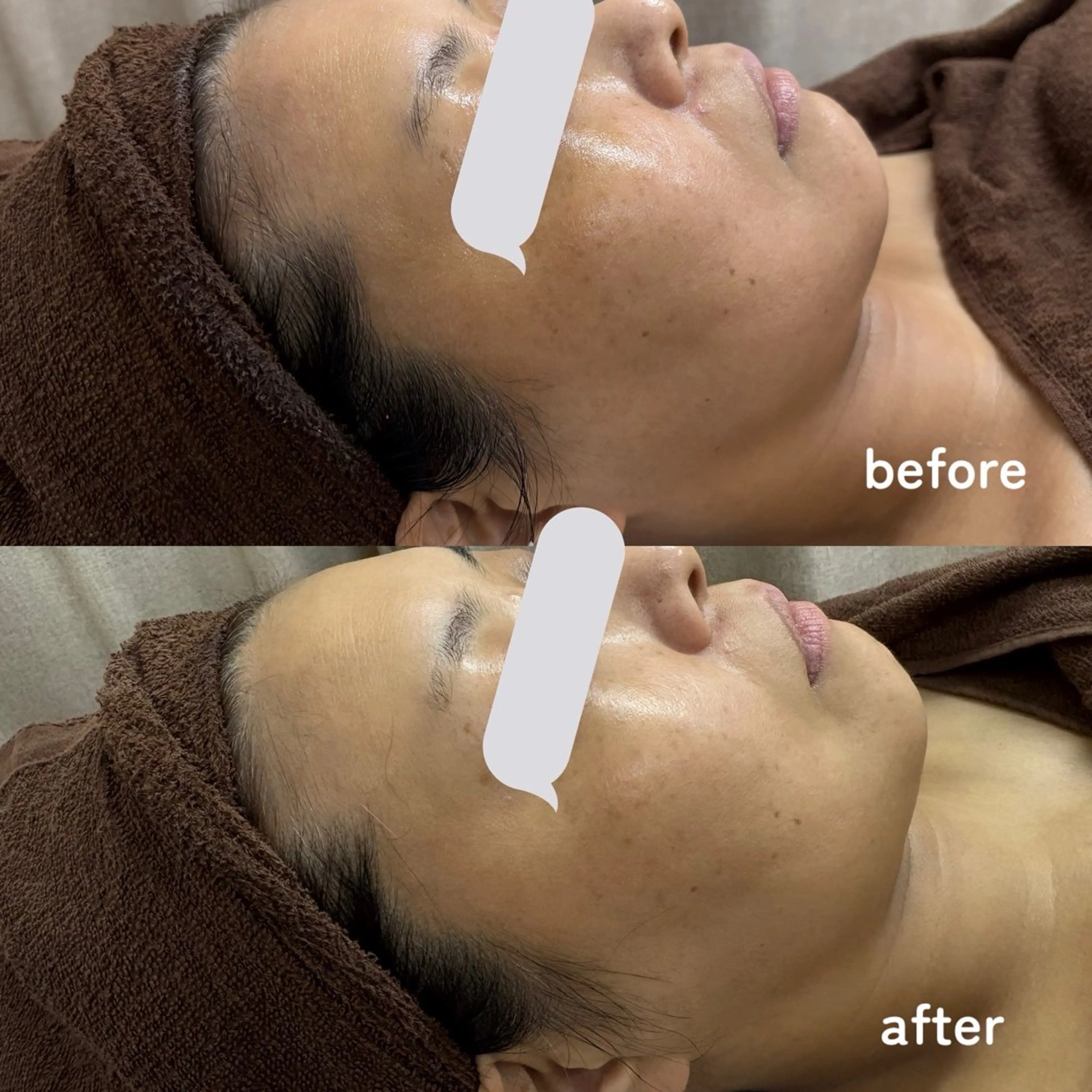 DeI'm東広島 エステサロンAMUのエステ・リラクイメージ