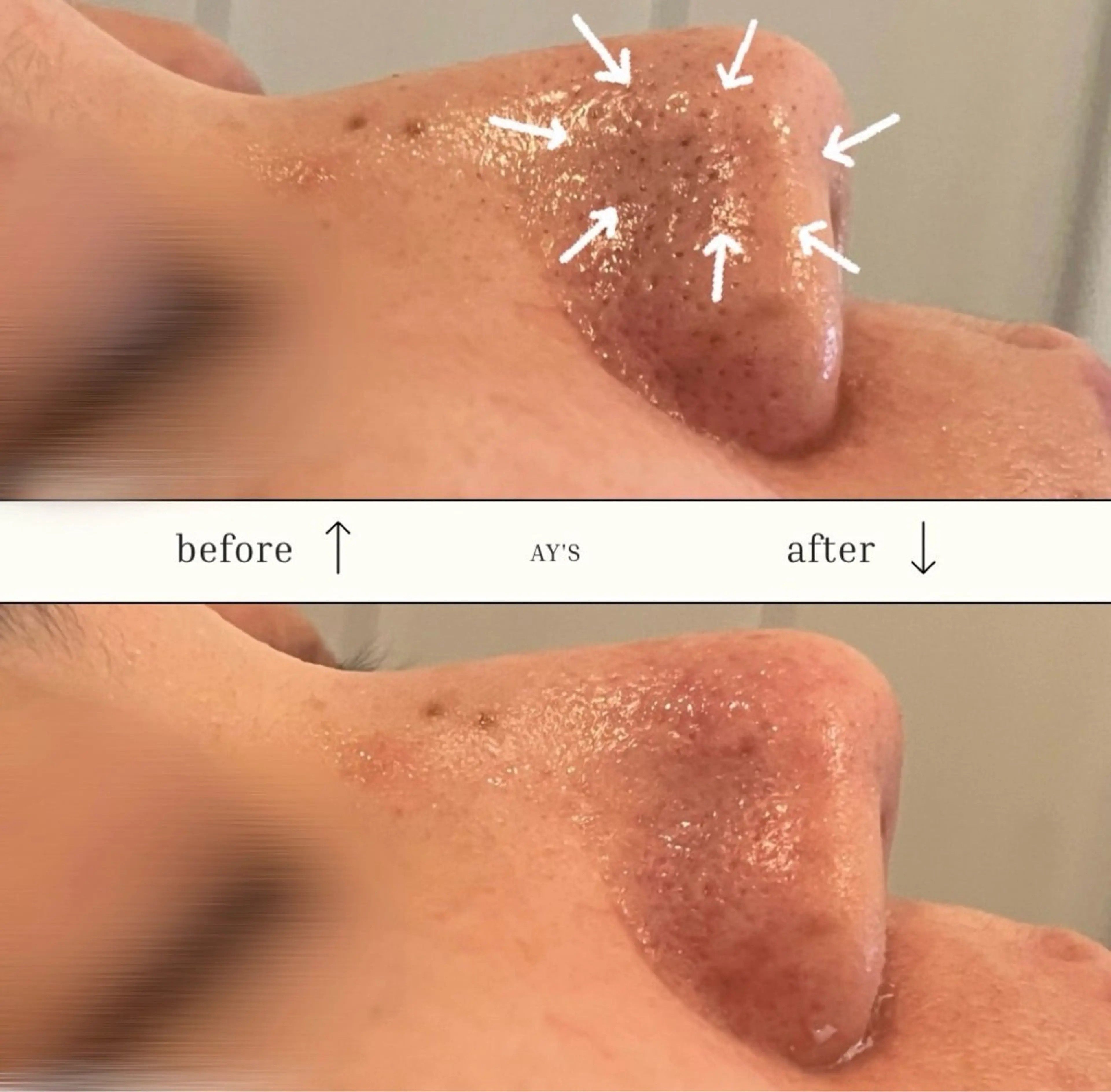 AY'S所属・倉敷/玉島/毛穴洗浄 古川碧のエステ・リラクイメージ