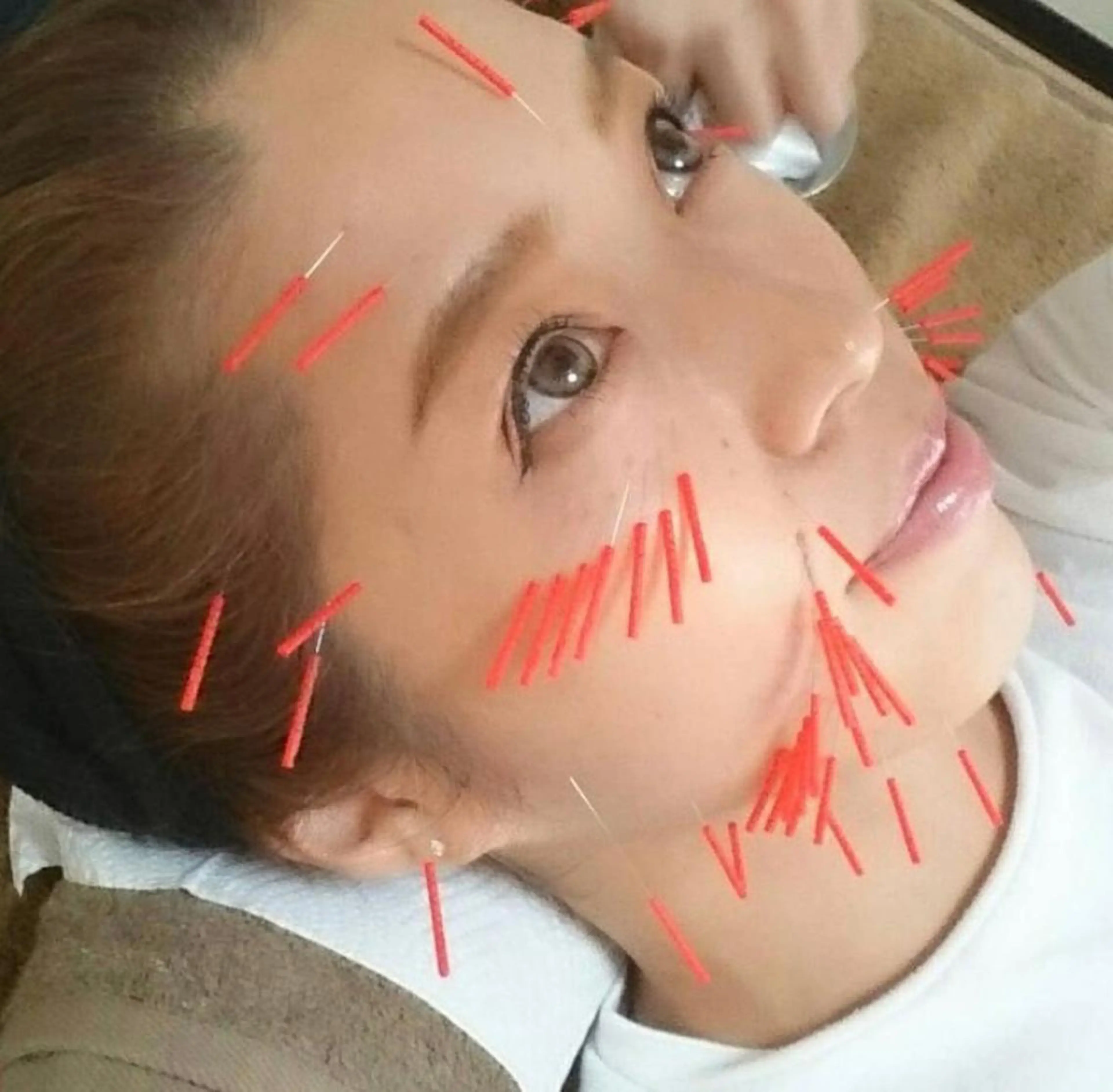 さや 鍼灸院のその他イメージ