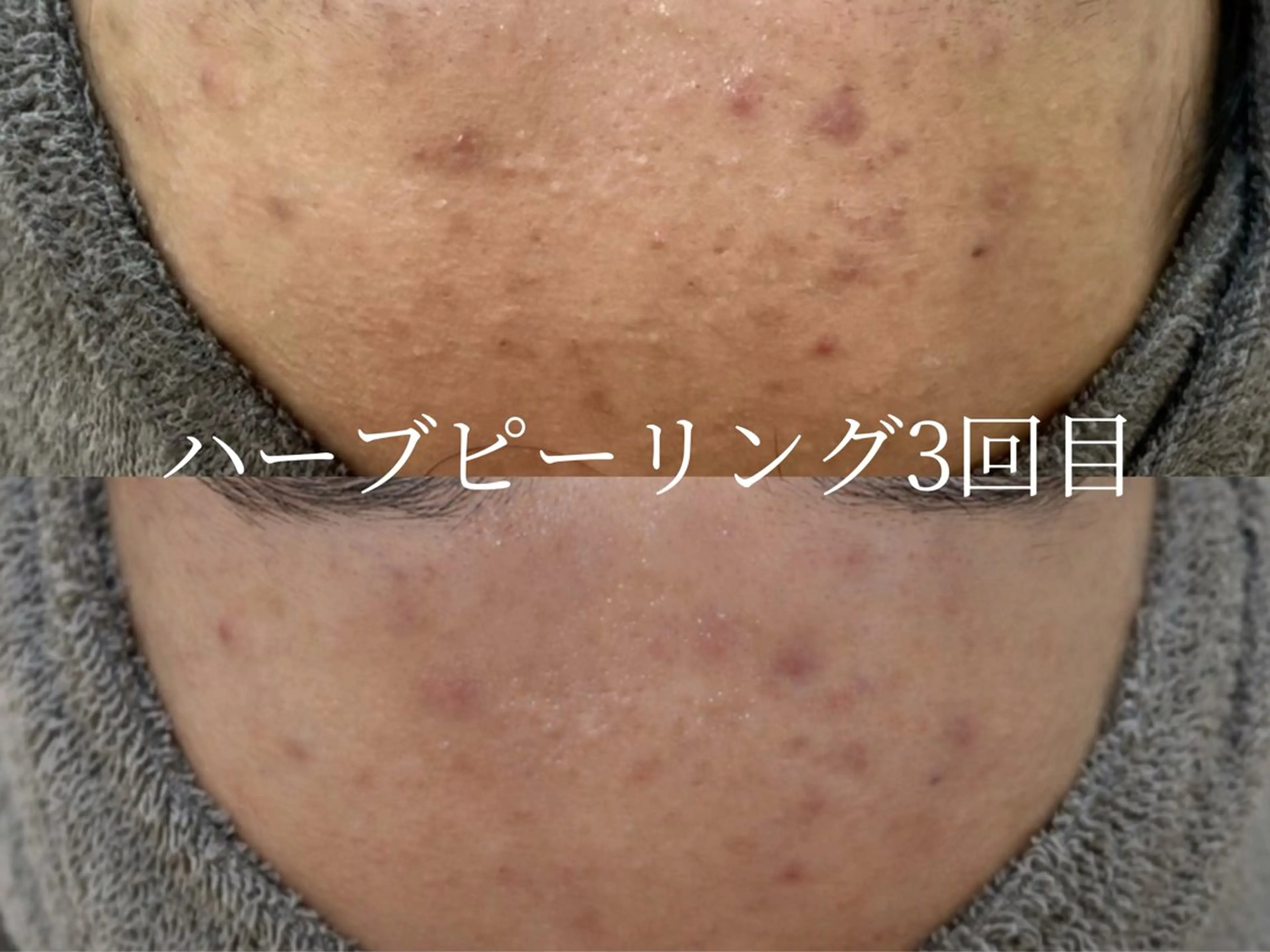 エステ foi sayaのエステ・リラクイメージ