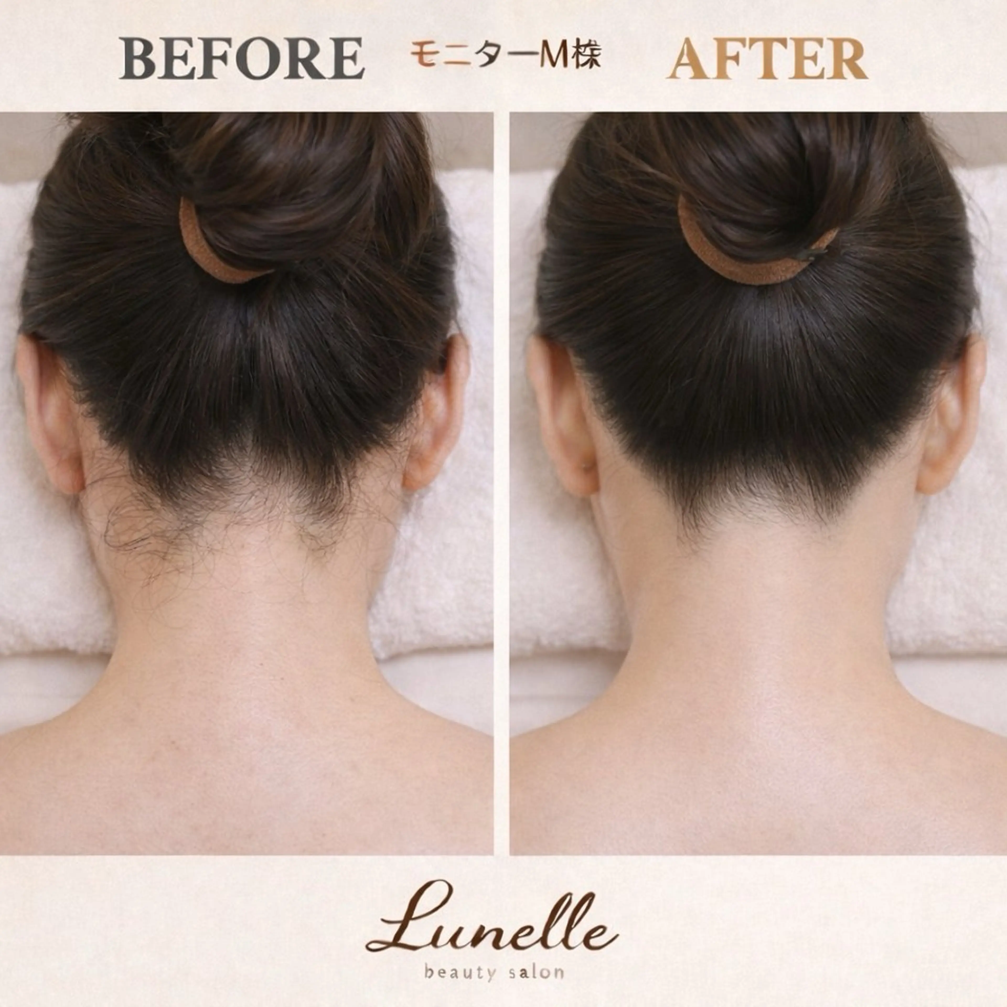 脱毛 脱毛×肌管理サロン ルネルのエステ・リラクイメージ