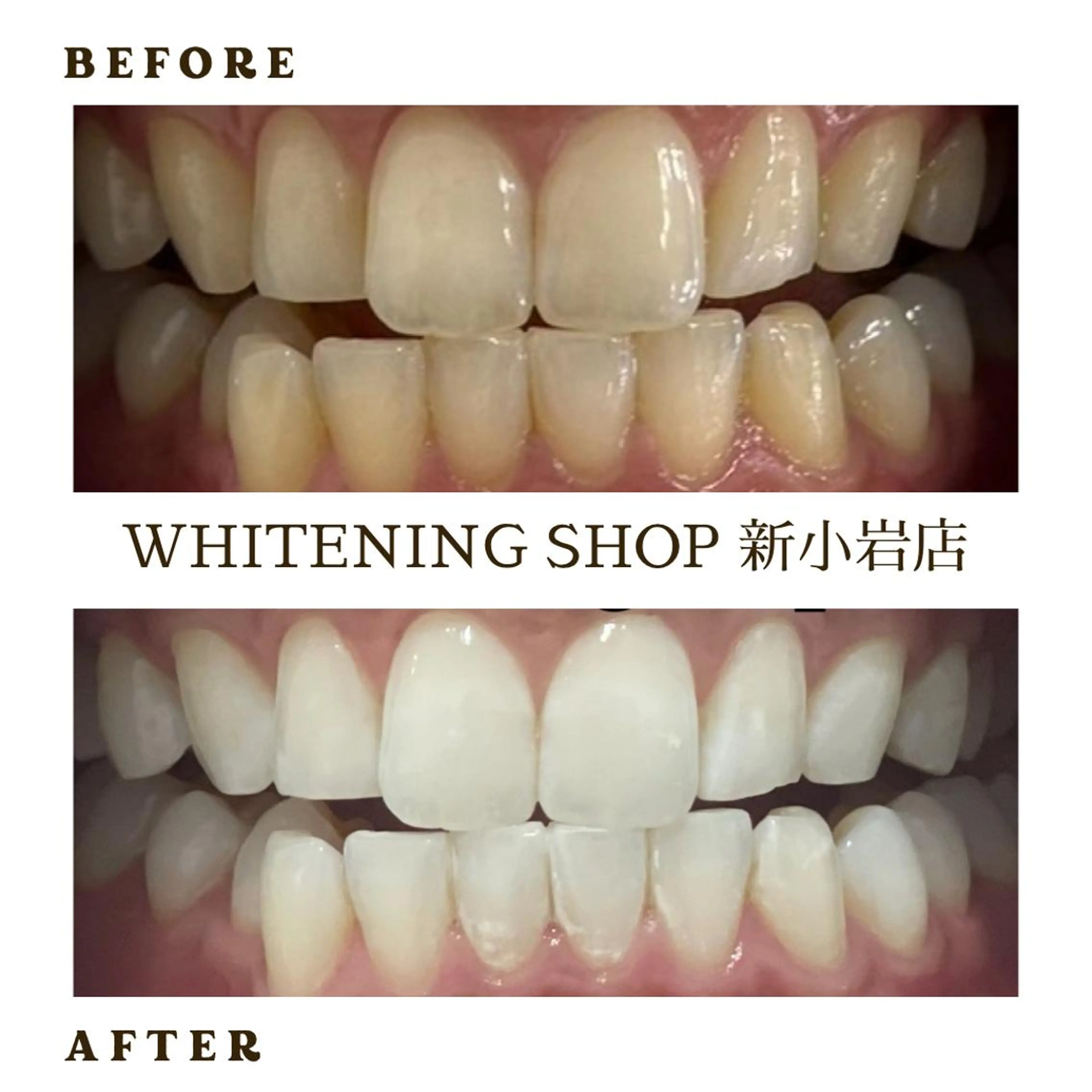 メンズ その他 ホワイトニング ショップ新小岩店のその他イメージ