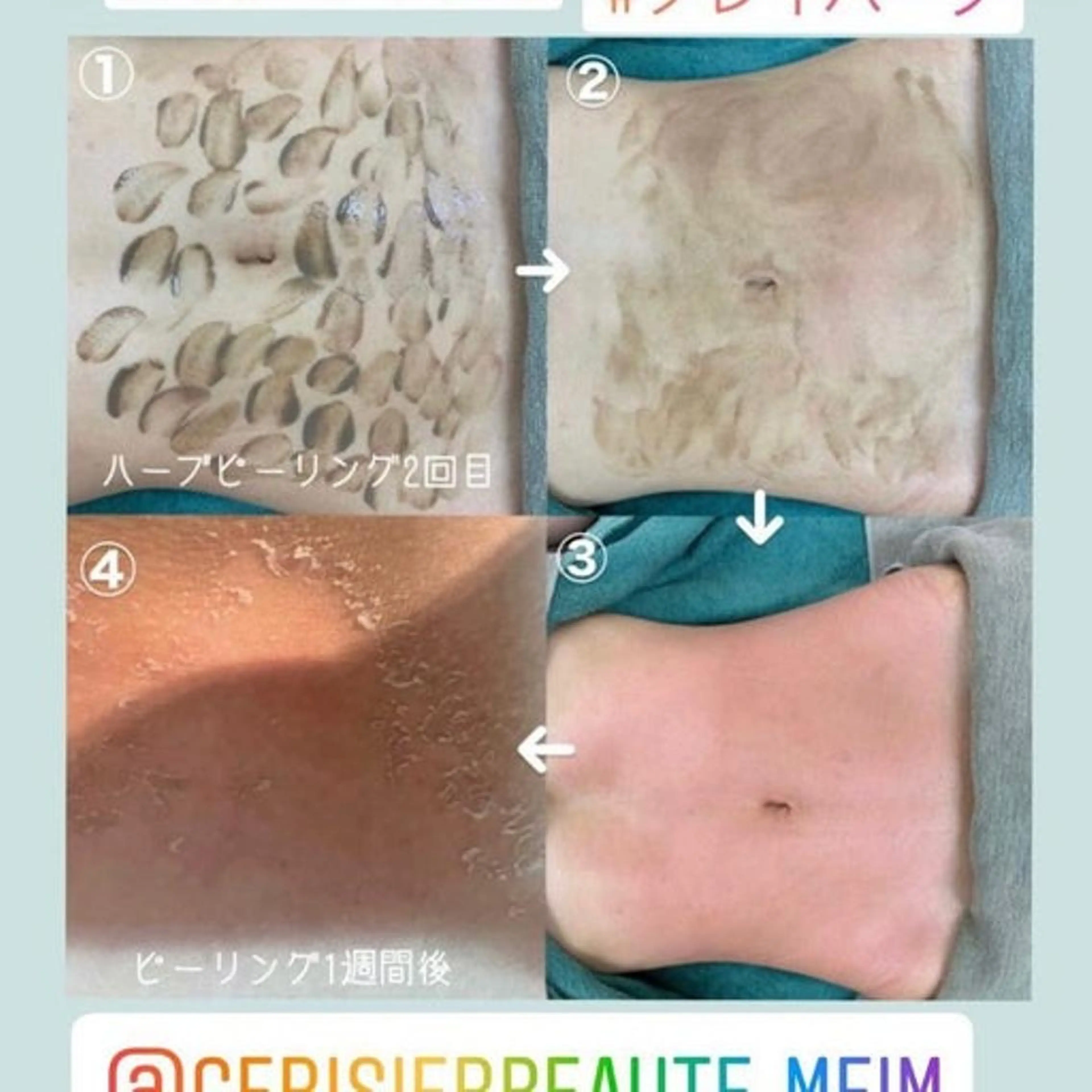 【ハーブピーリング&アロマリンパマッサージ nana】医療提携サロン所属・美肌&アロマ🌸 nana 中目黒のエステ・リラクイメージ