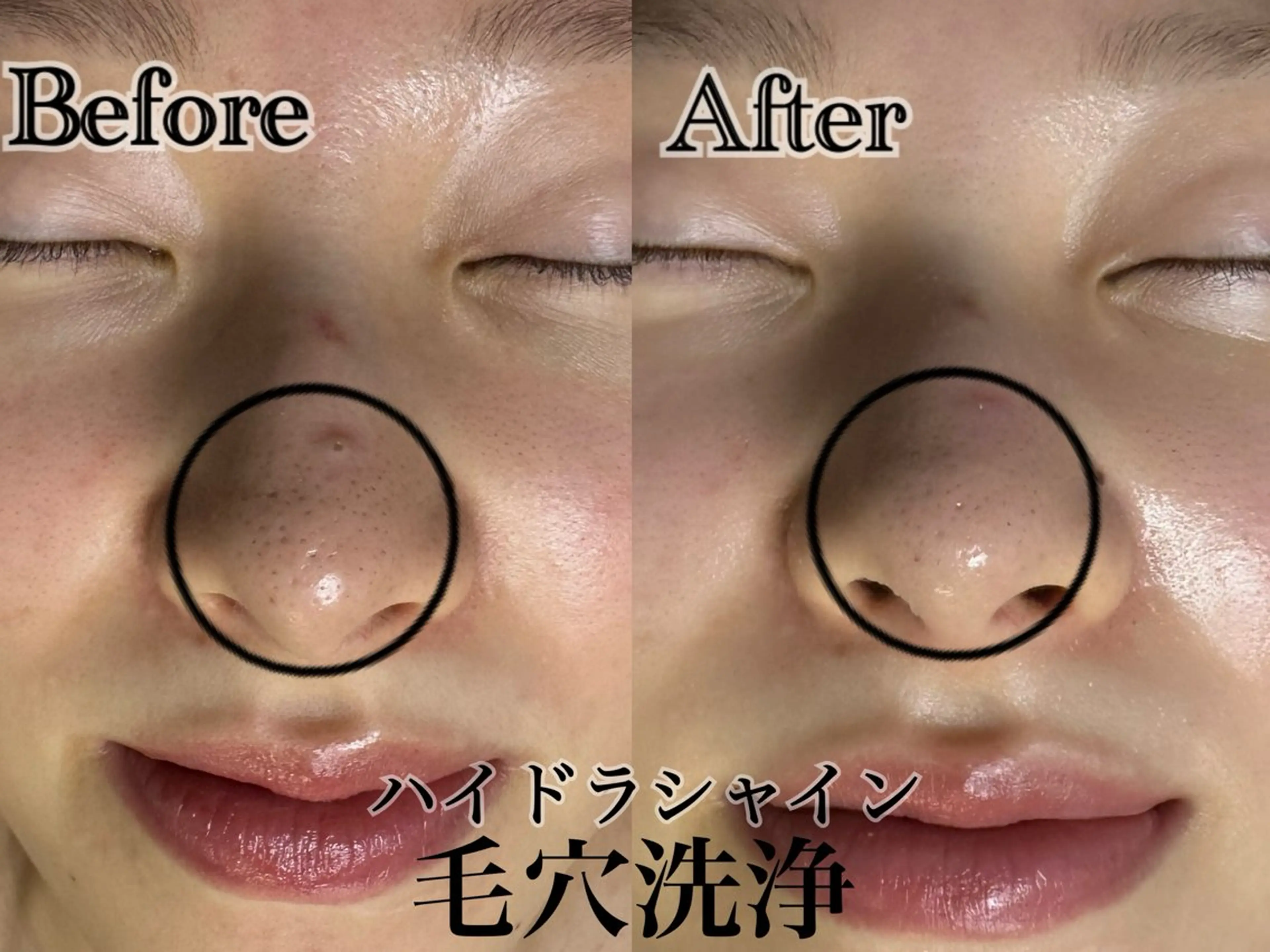 エステ 六本木脱毛andS 店長Sachiのエステ・リラクイメージ