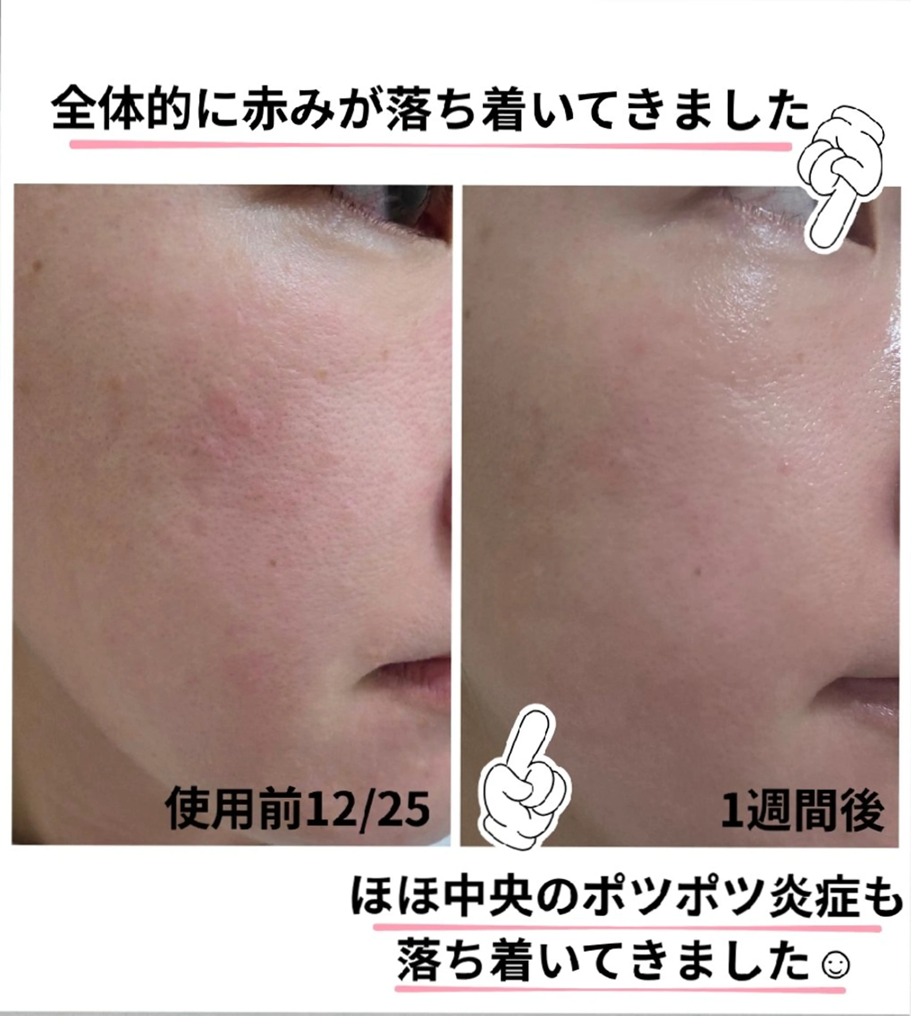 エステ 上尾Luce. あきやまのエステ・リラクイメージ