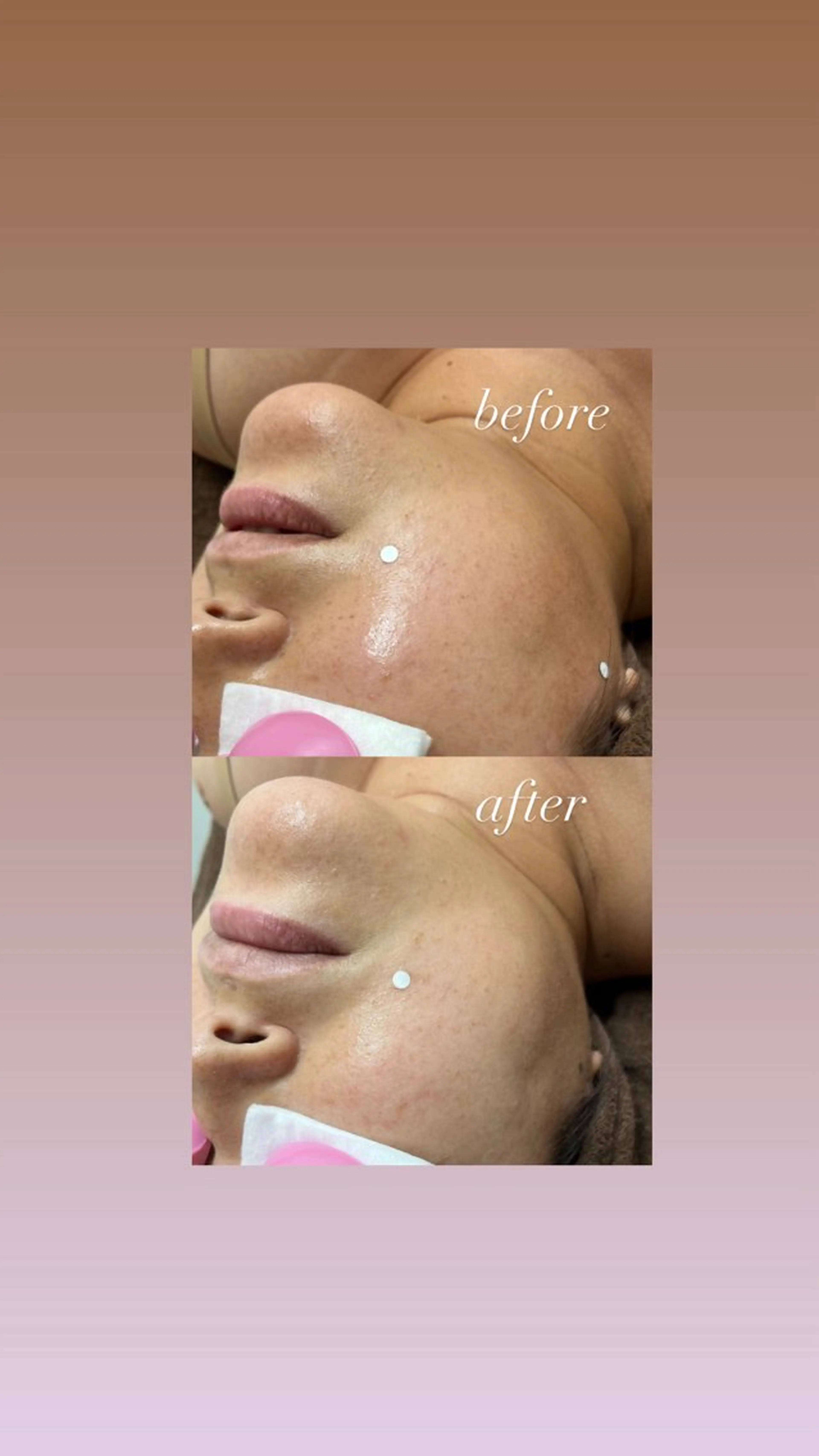 その他 smileskin 京都／meguのその他イメージ