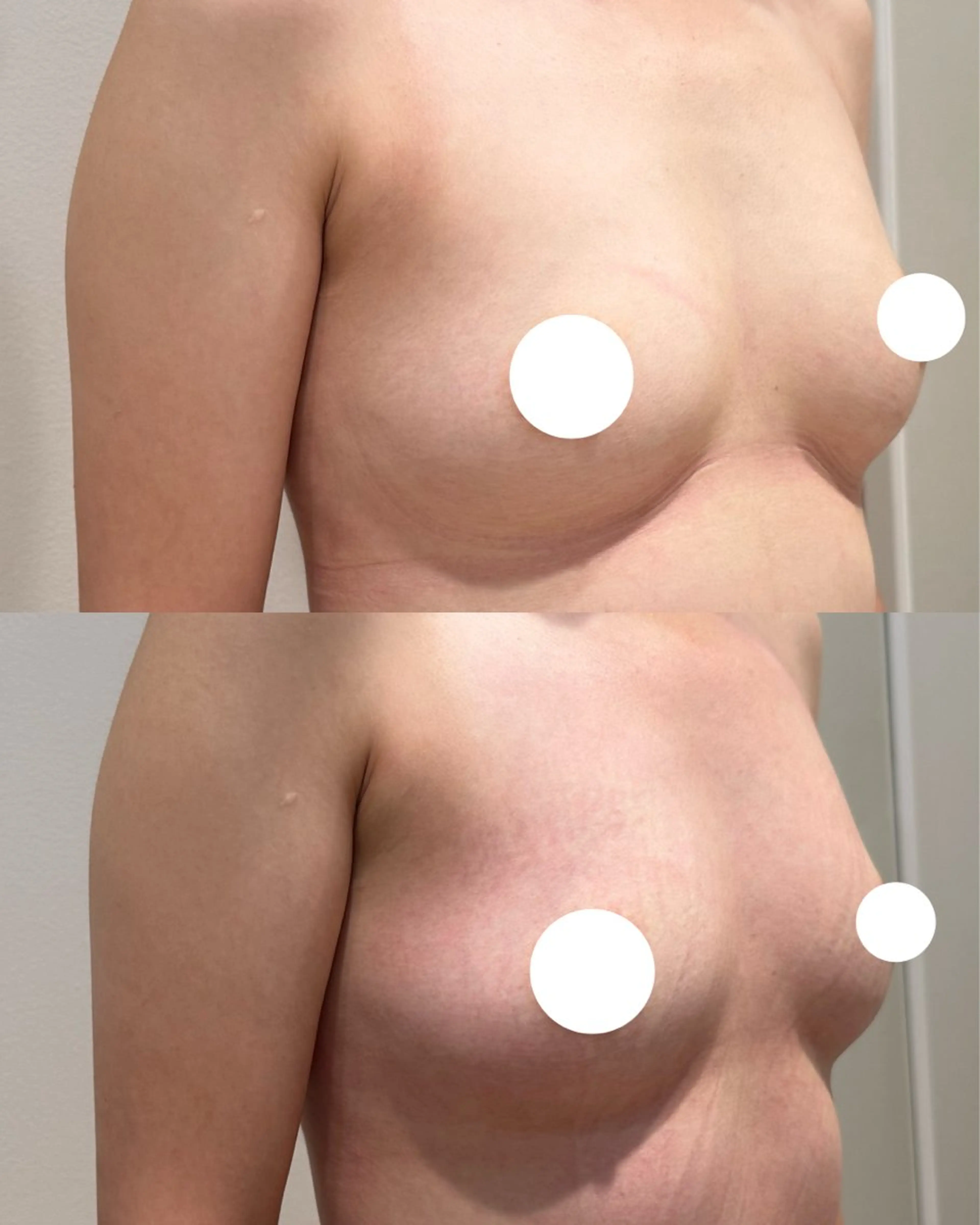 エステ beautysalon RAVIS所属・東大阪/韓国肌管理/ 痩身バスト専門店のエステ・リラクイメージ