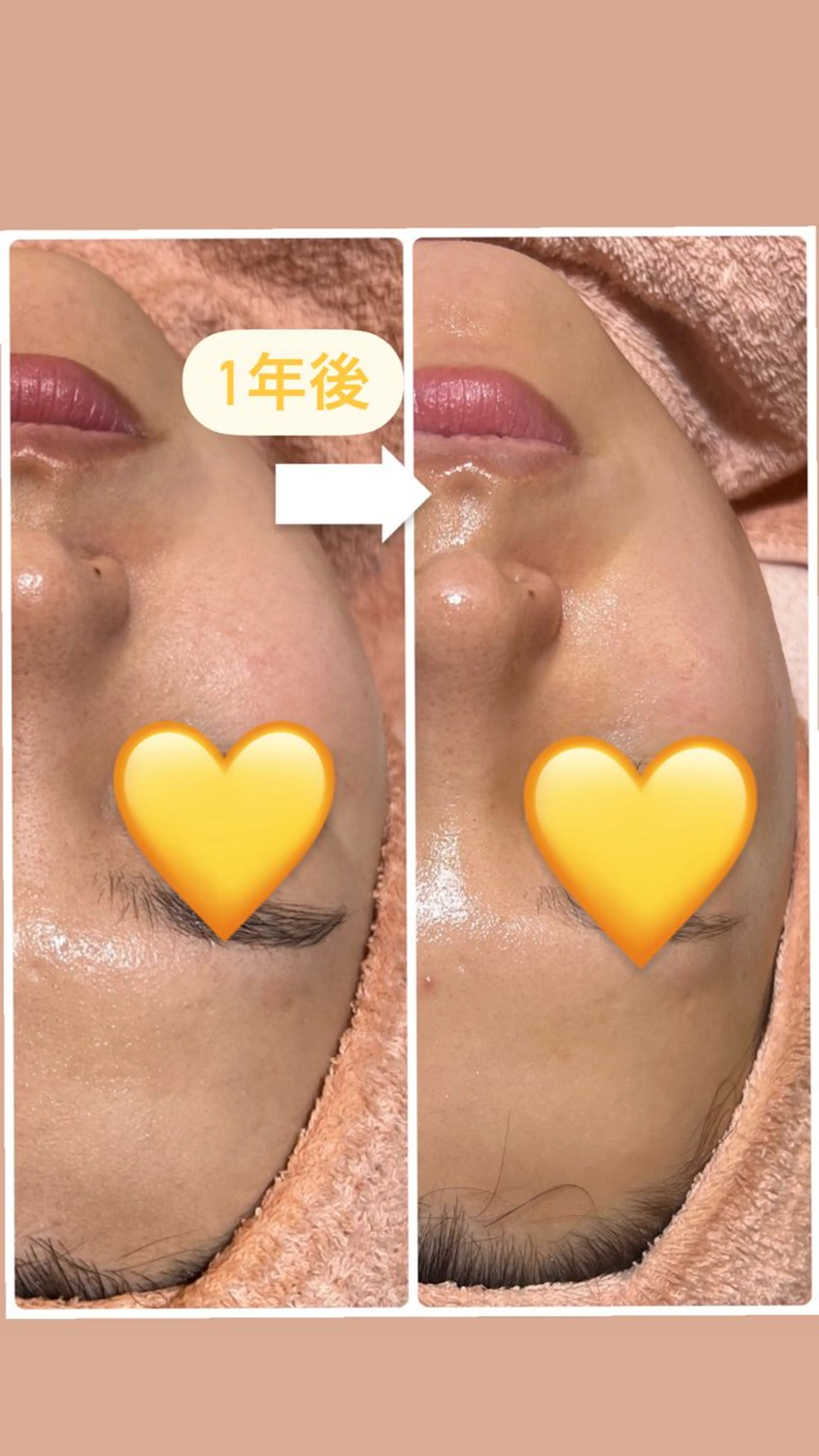 W MISATOのエステ・リラクイメージ