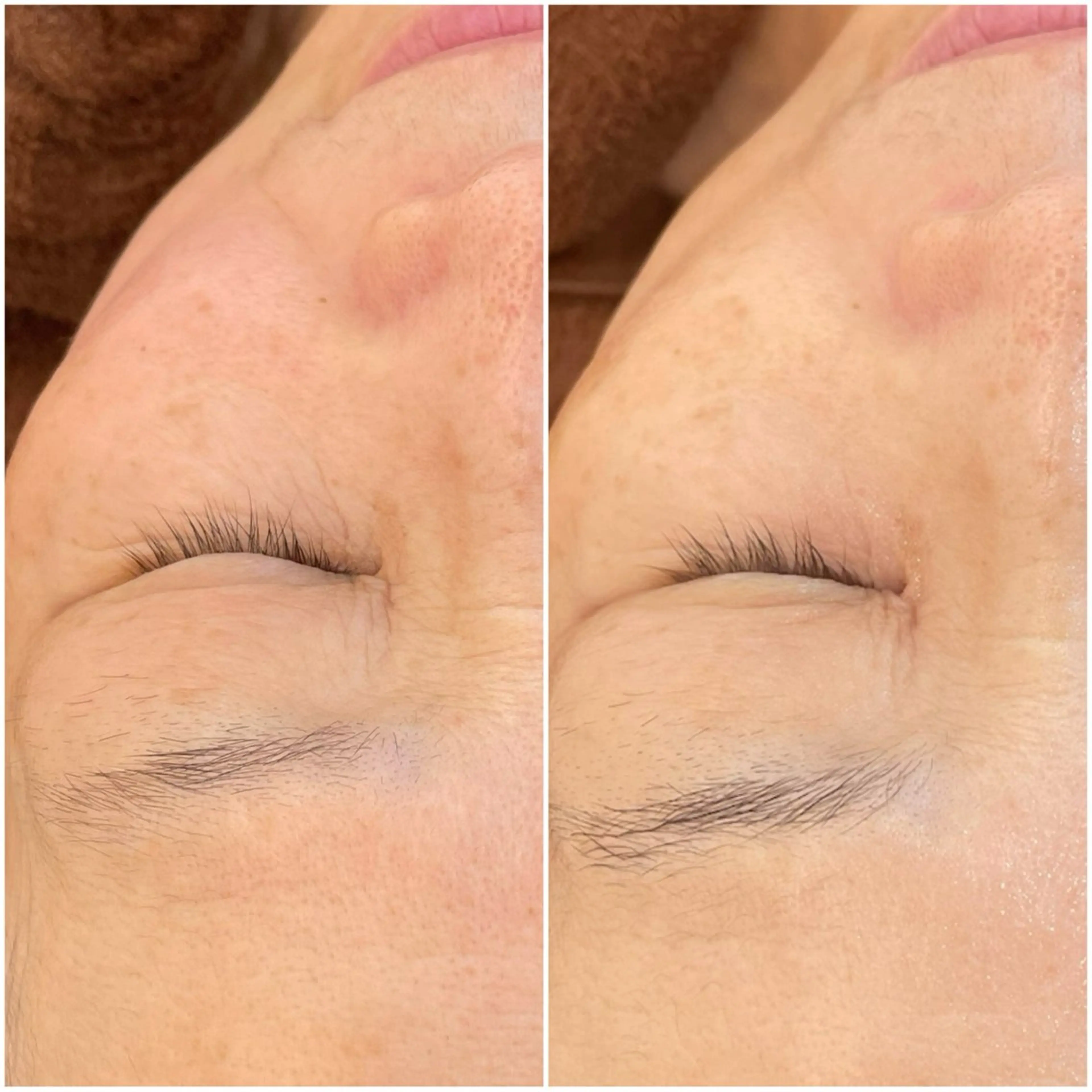 パーソナル肌質改善 🦋APRI🅿️有のエステ・リラクイメージ