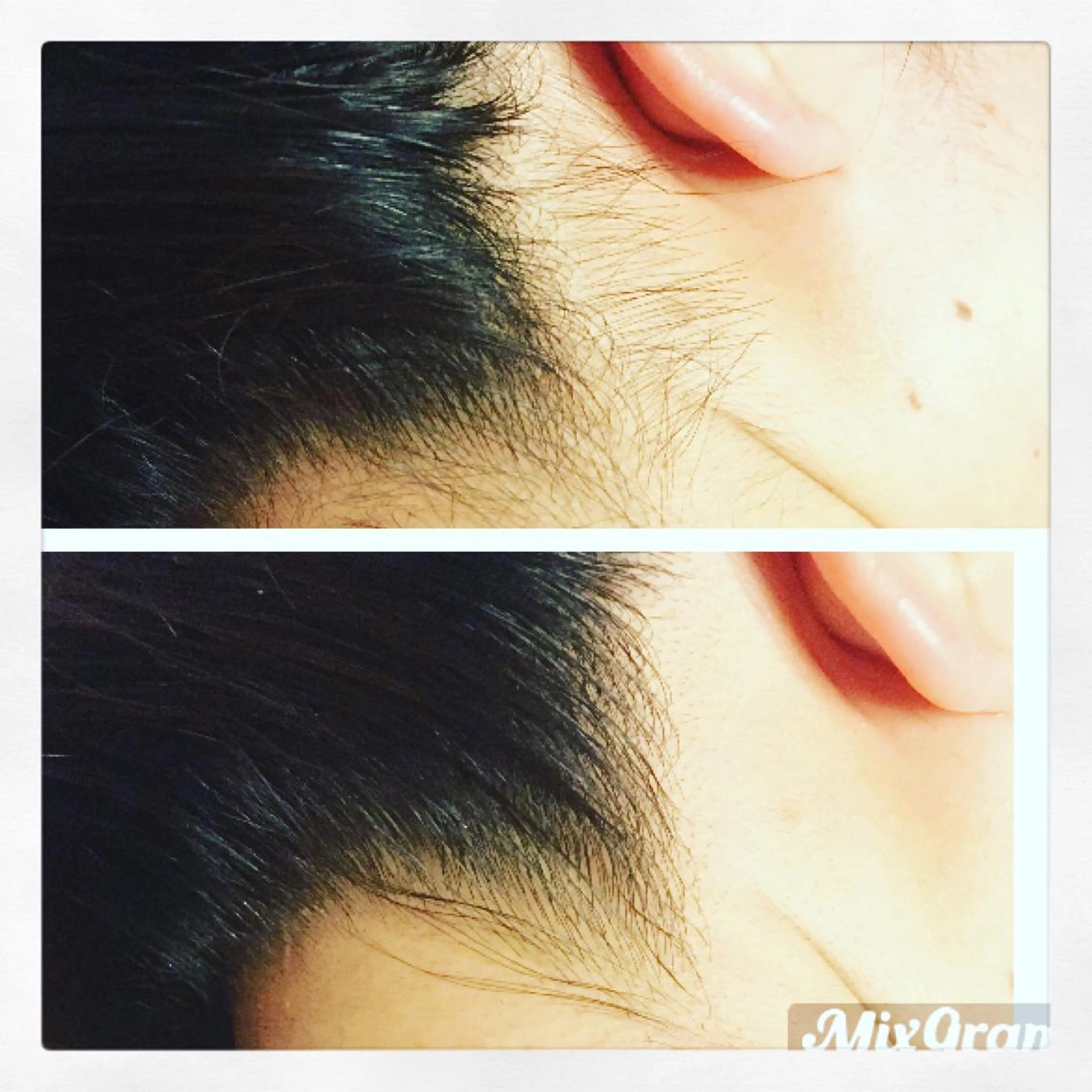 誰よりも綺麗に✨人気のうなじ脱毛✨+ワキ脱毛をお得な価格で❣️❣️是非この機会に❤️の写真