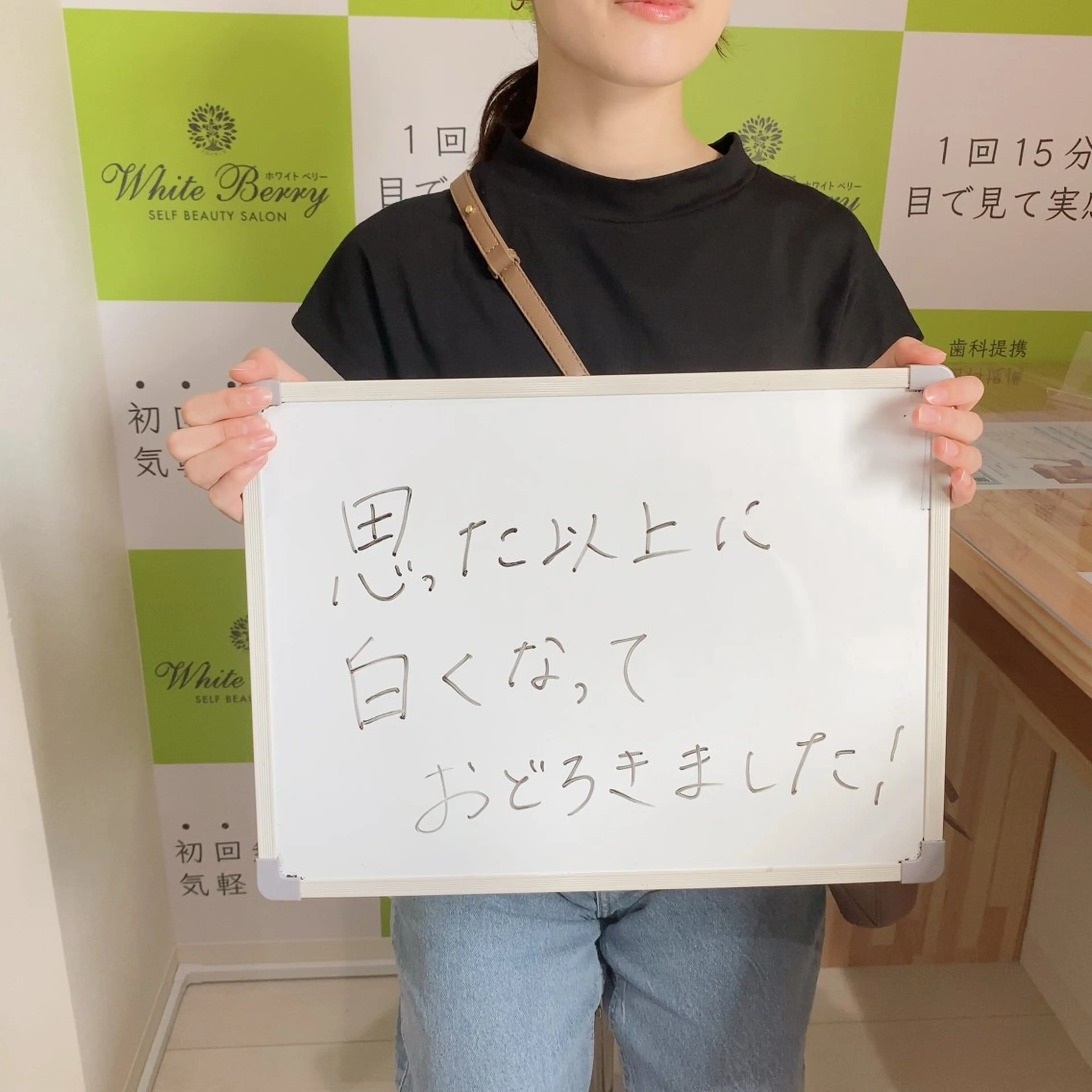 White Berry SELF BEAUTY SALON所属・セルフホワイトニング 🦷口元垢抜け✨のその他イメージ