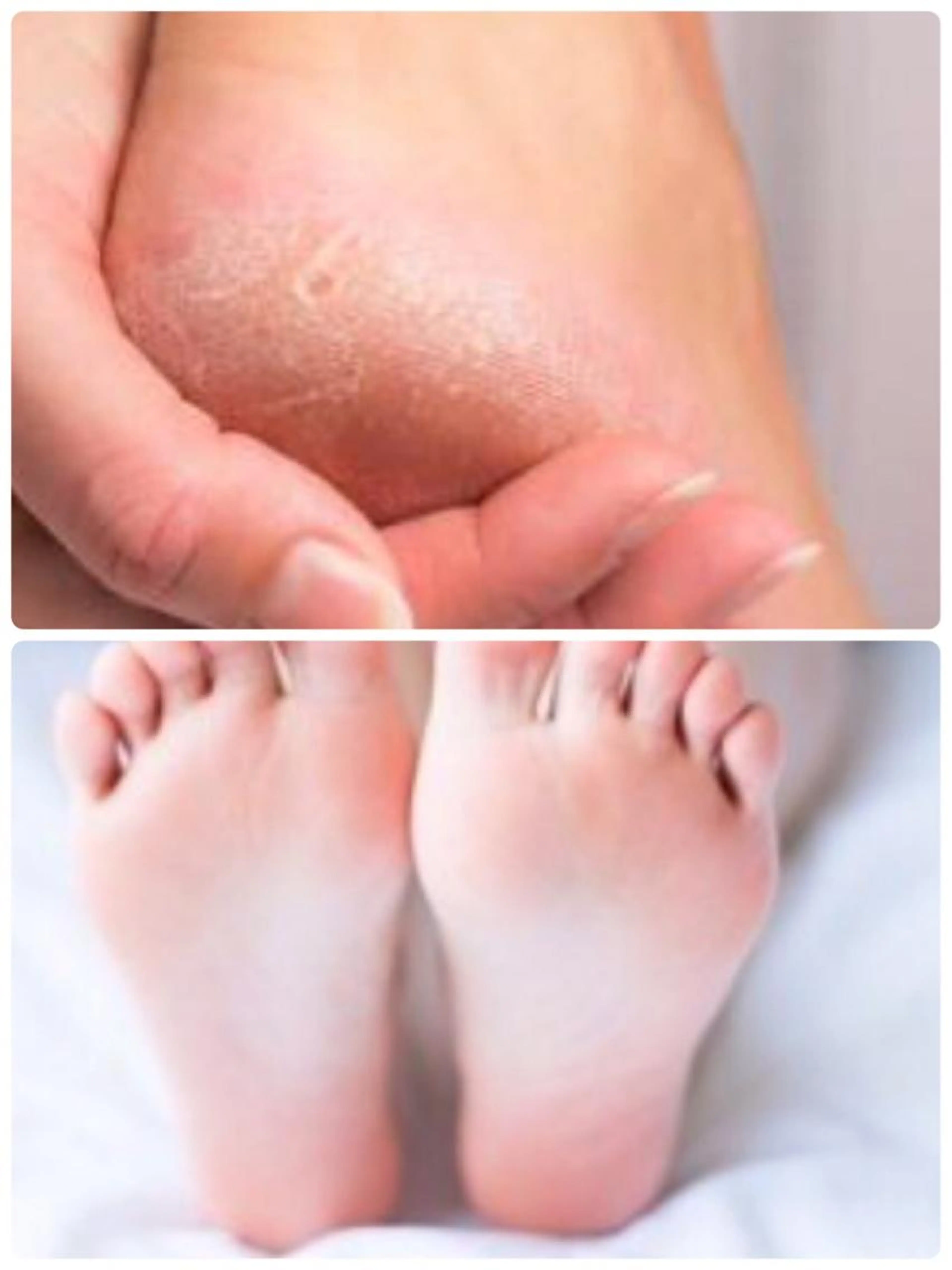【全員使用可】足裏ケア👣✨いらない足の角質を取り除きます🔸ストッキングが引っかかる方🔸足の臭いが気になる方の写真