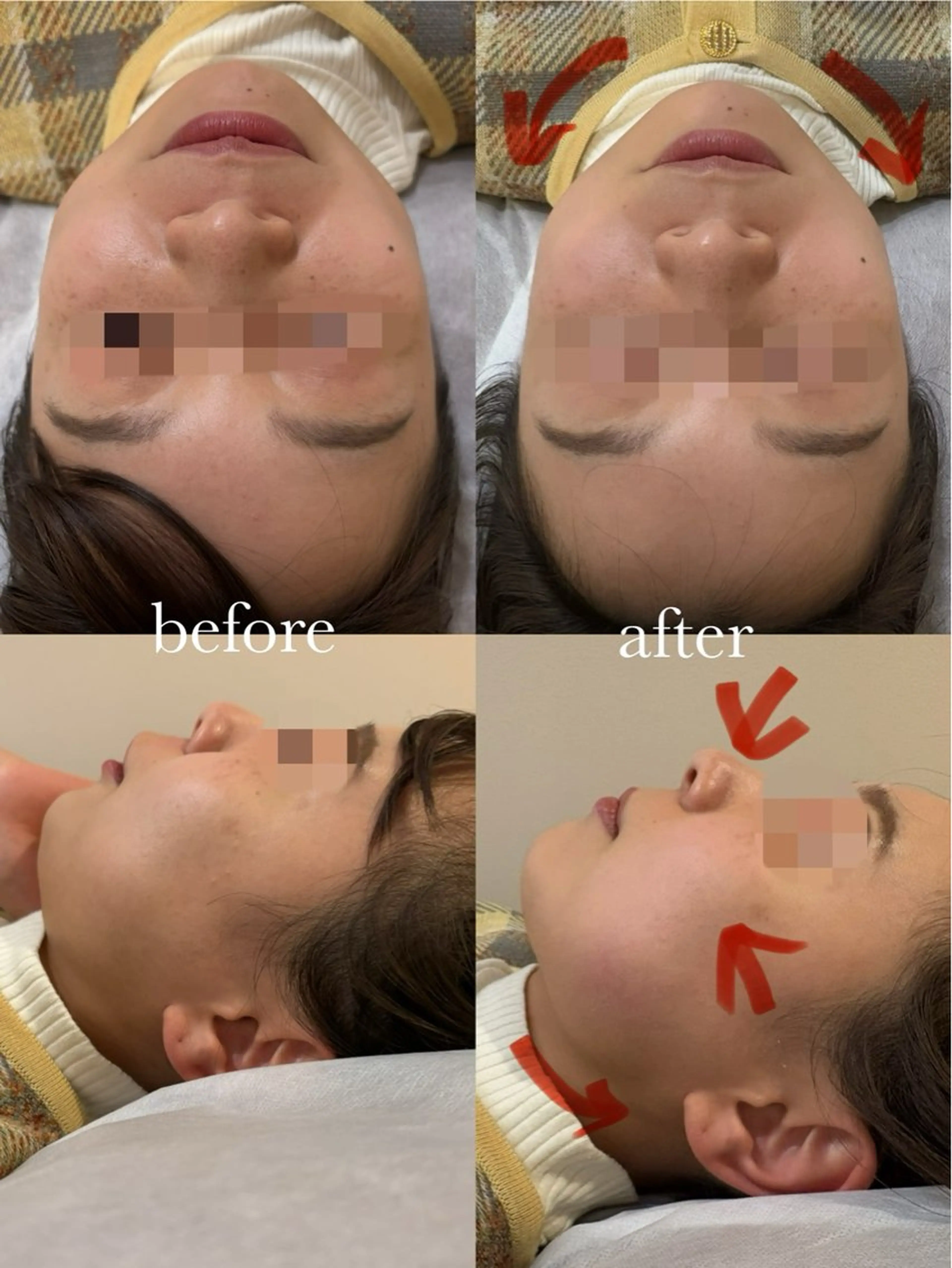 【小顔整体】お顔の歪みは身体全体の改善から✨60分の写真