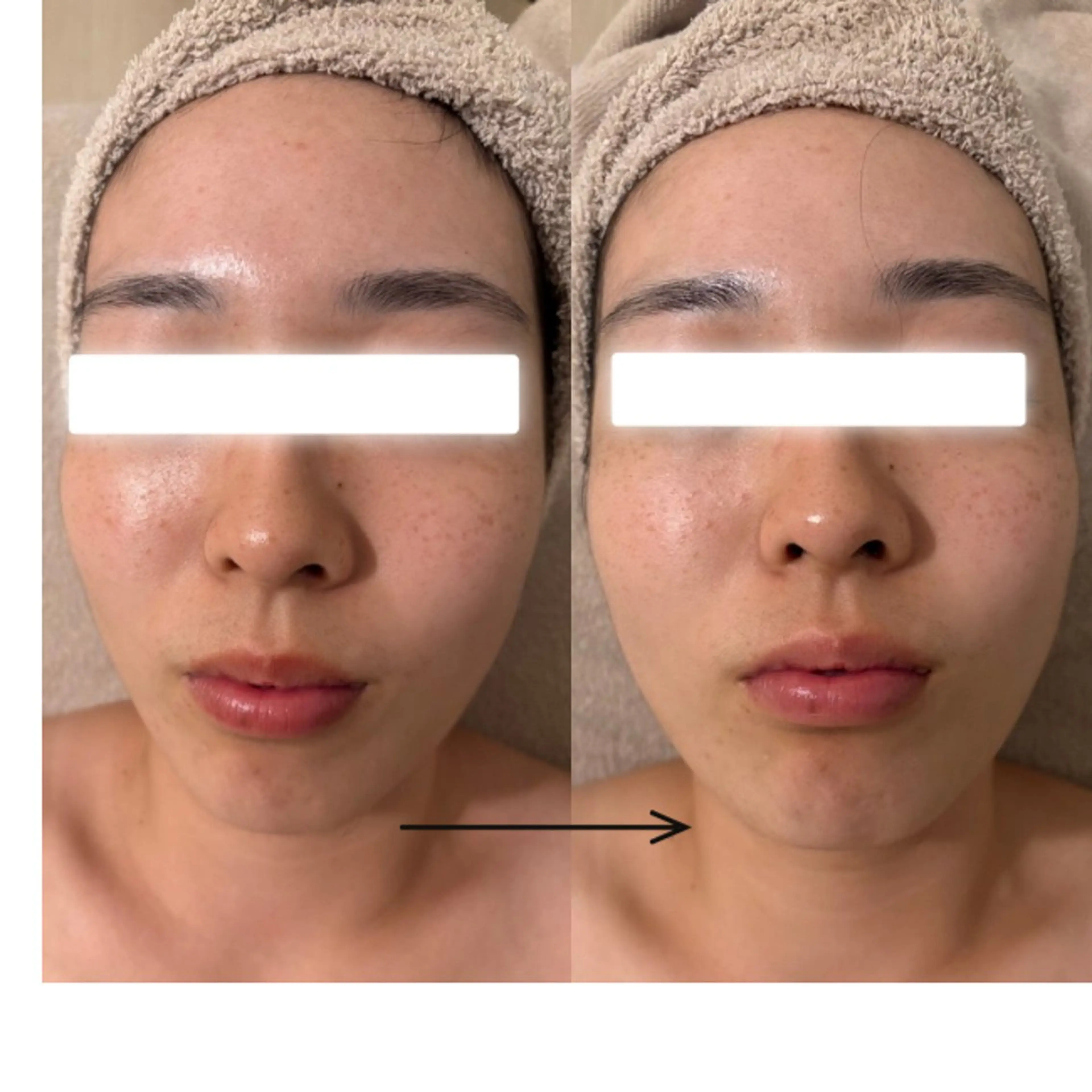 POLA THE BEAUTY 天王寺店所属・UEDA | POLA 天王寺のエステ・リラクイメージ