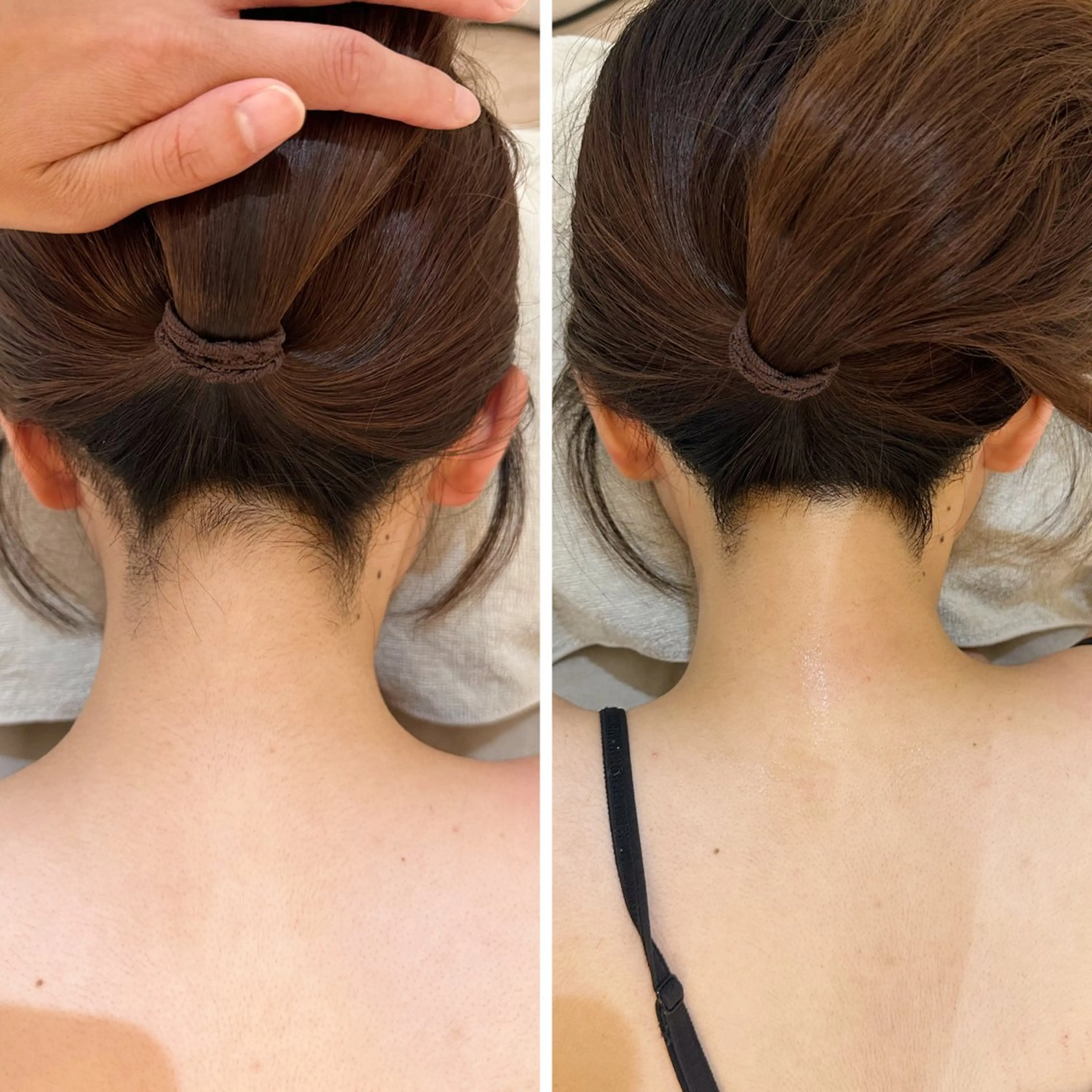 脱毛 うなじ脱毛/美肌脱毛 LABELのエステ・リラクイメージ