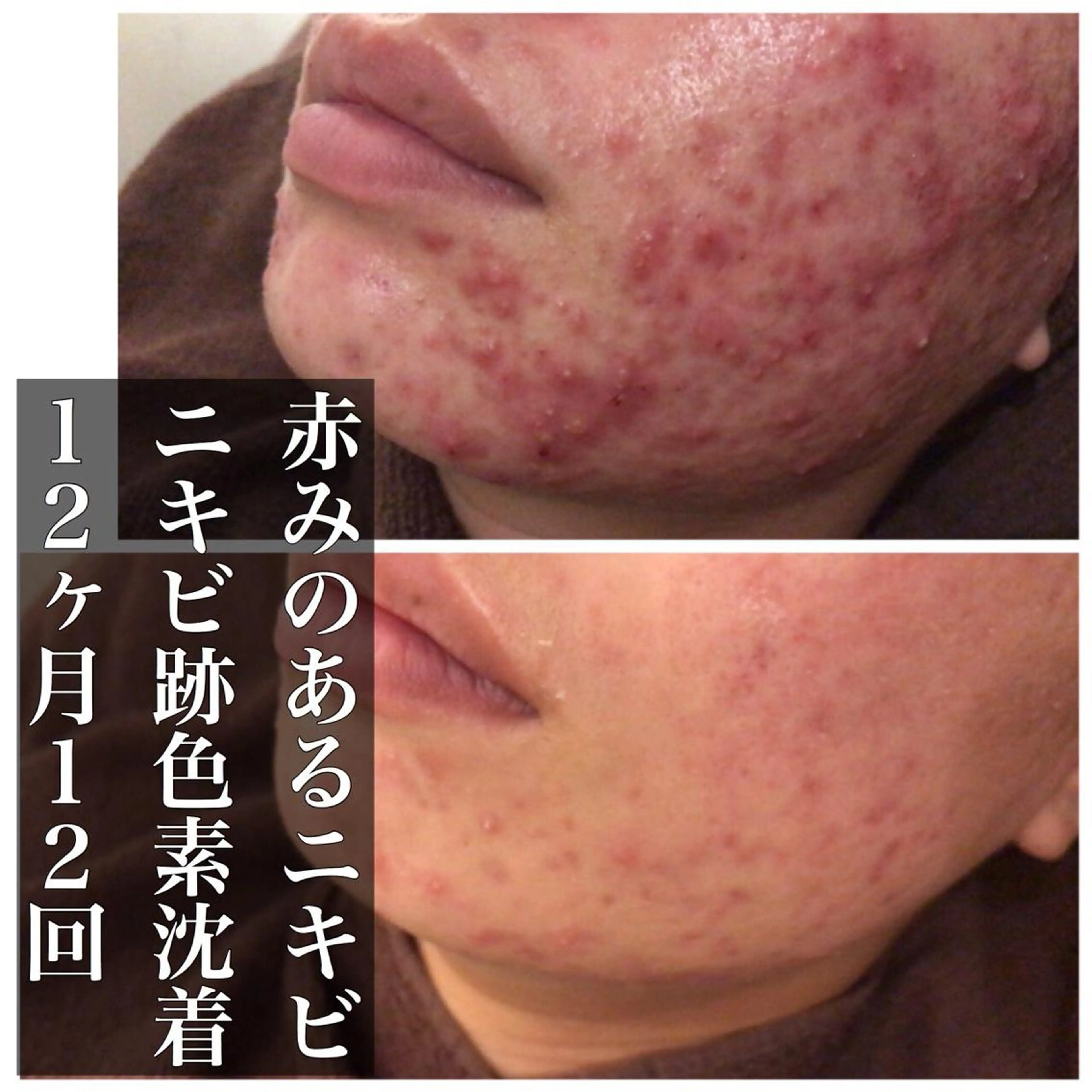 ミディアム カラー パーマ ヘアアレンジ メンズ キッズ ネイル マツエク・マツパ エステ リラク ニキビ・肌質改善専門 ♡人生が変わるサロンのエステ・リラクイメージ