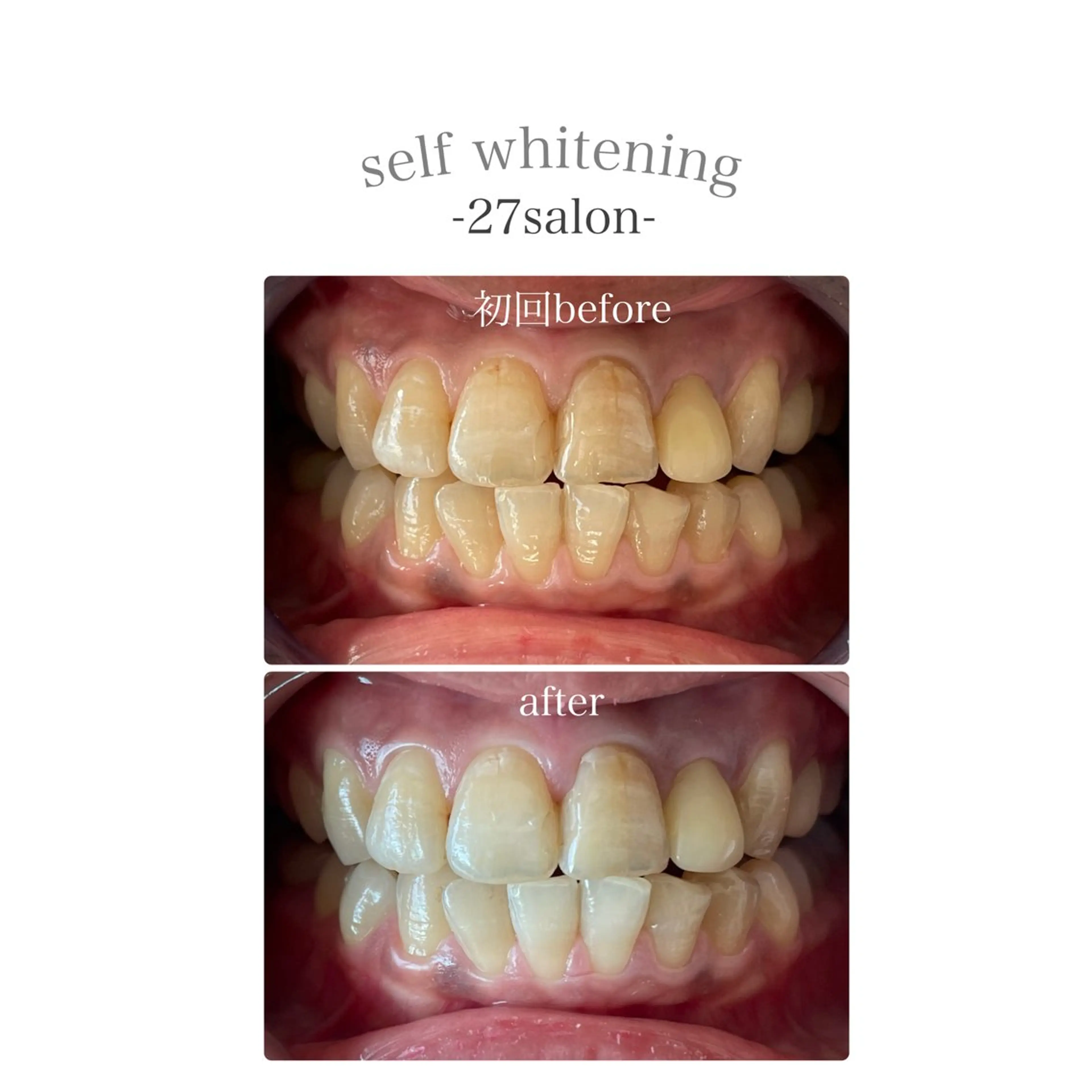 その他 27salon yuinaのネイルデザイン