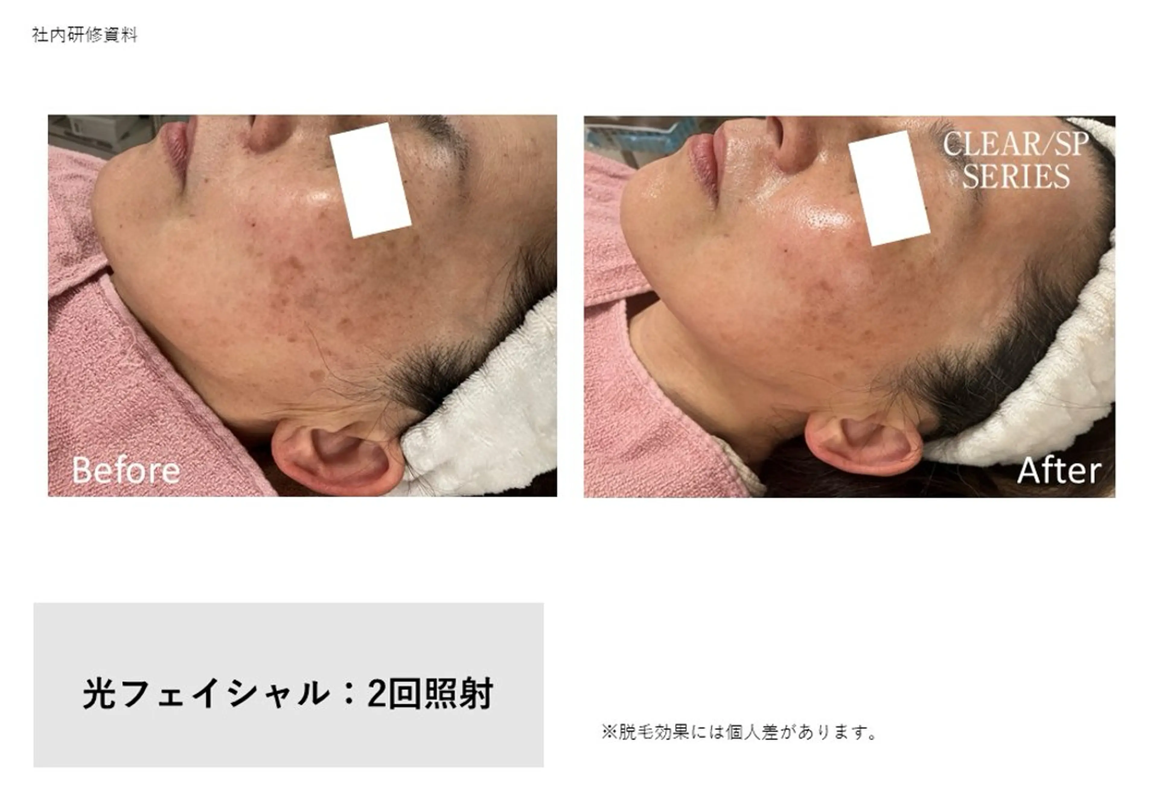 エステ LeCoeur喜多町 松本のエステ・リラクイメージ