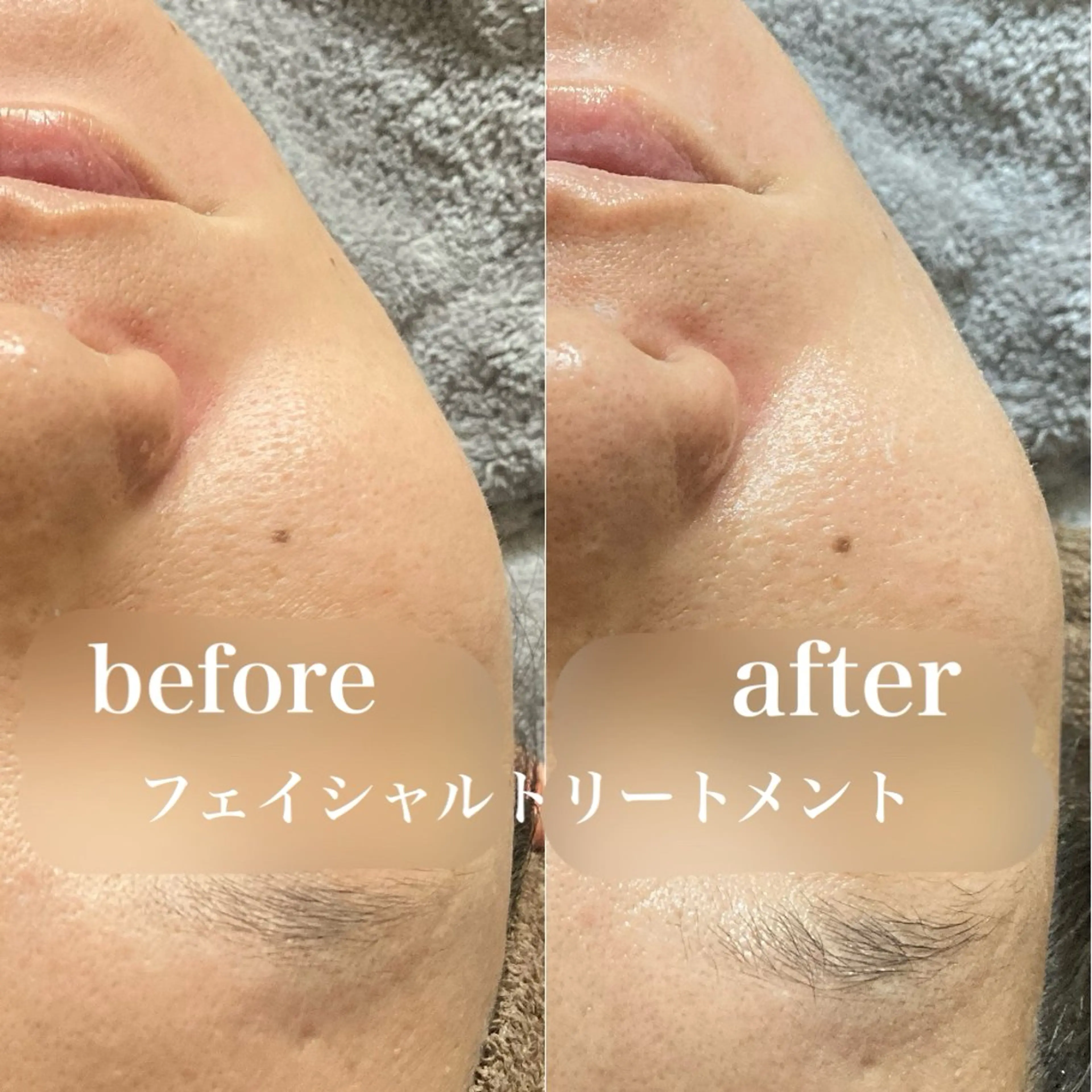 磐田｜LAYLA 一番丁寧な脱毛店のエステ・リラクイメージ