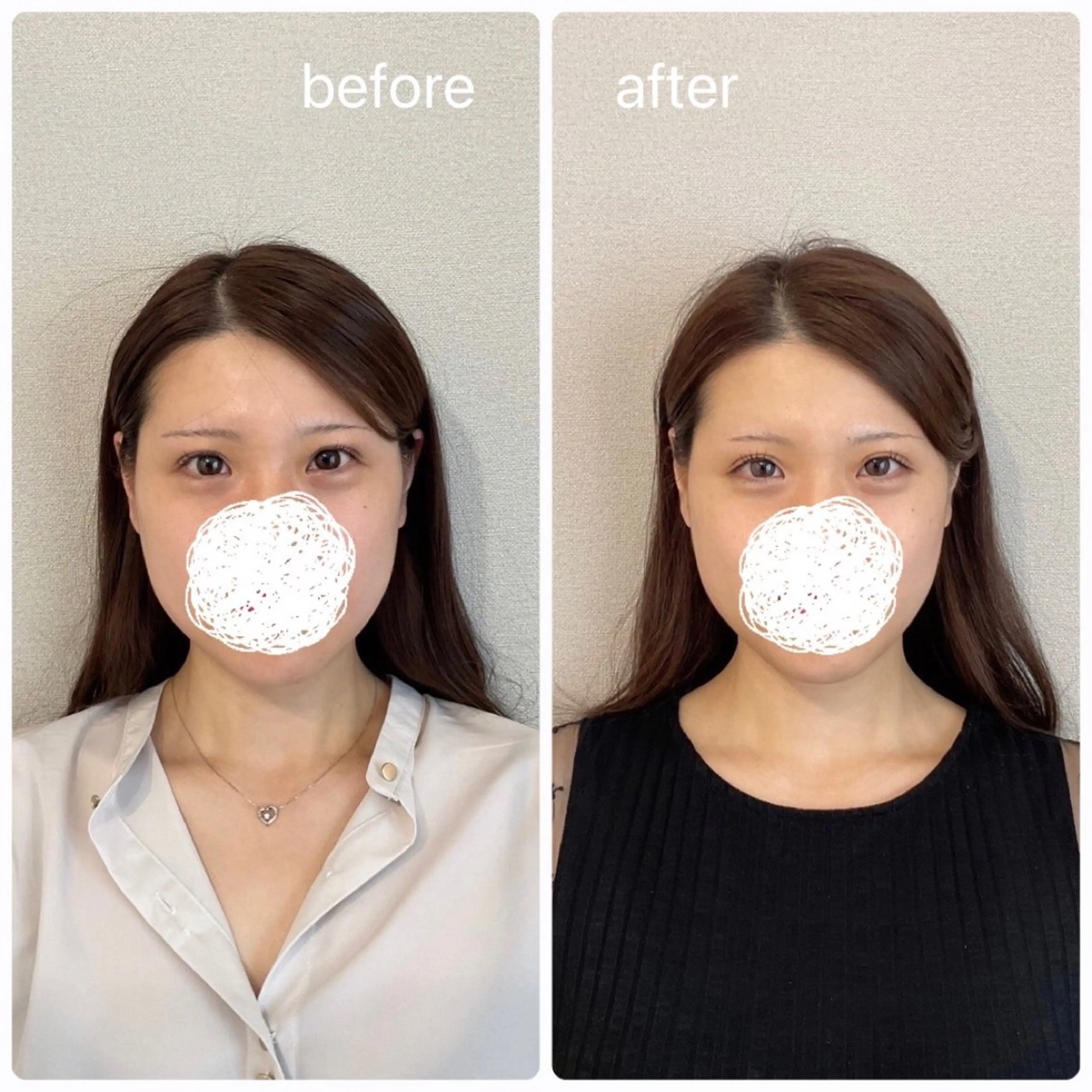 美容鍼×小顔×姿勢× ブライダル整体のエステ・リラクイメージ