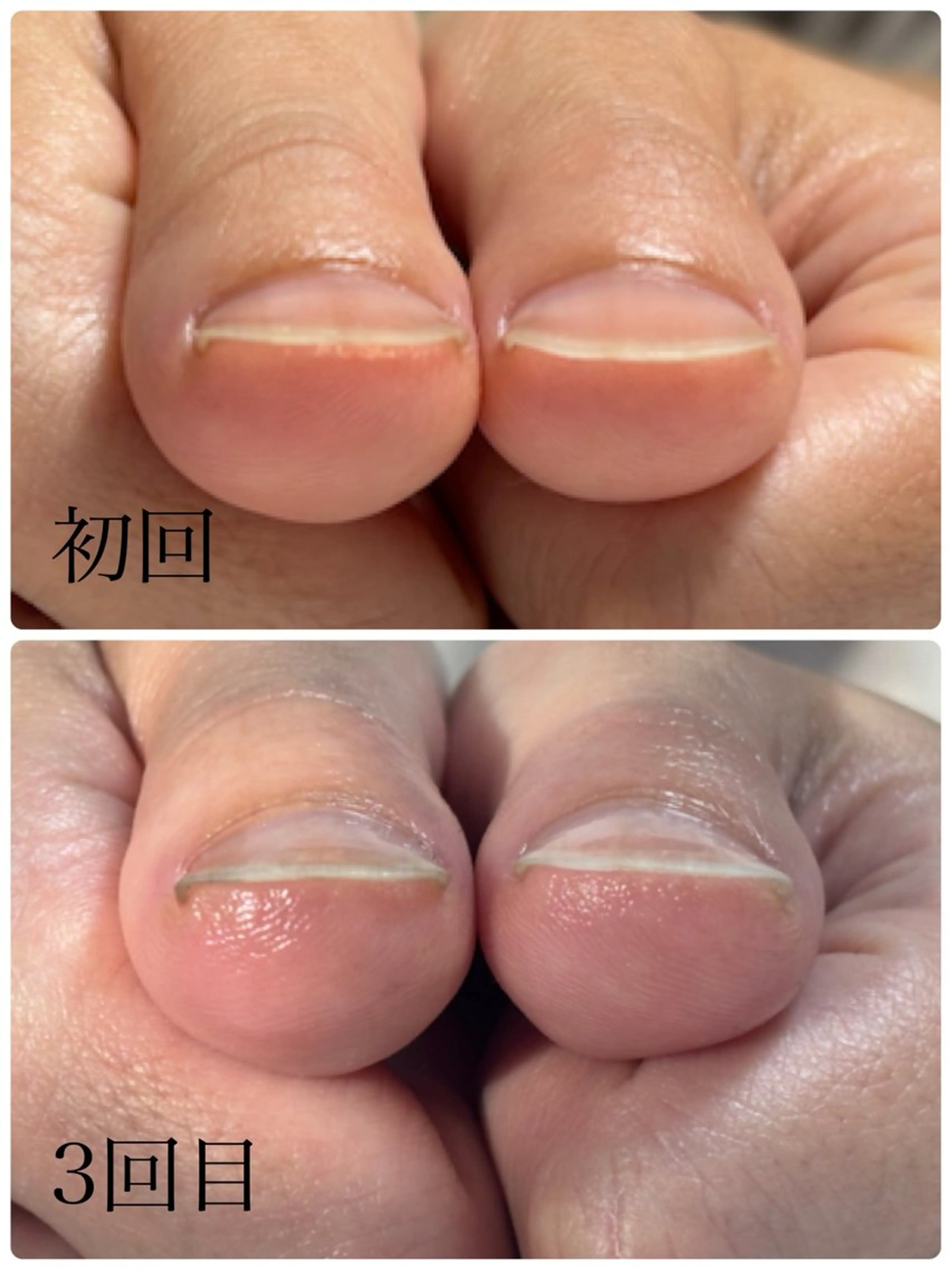 ネイル Alo.nail アロ•ネイルのネイルデザイン