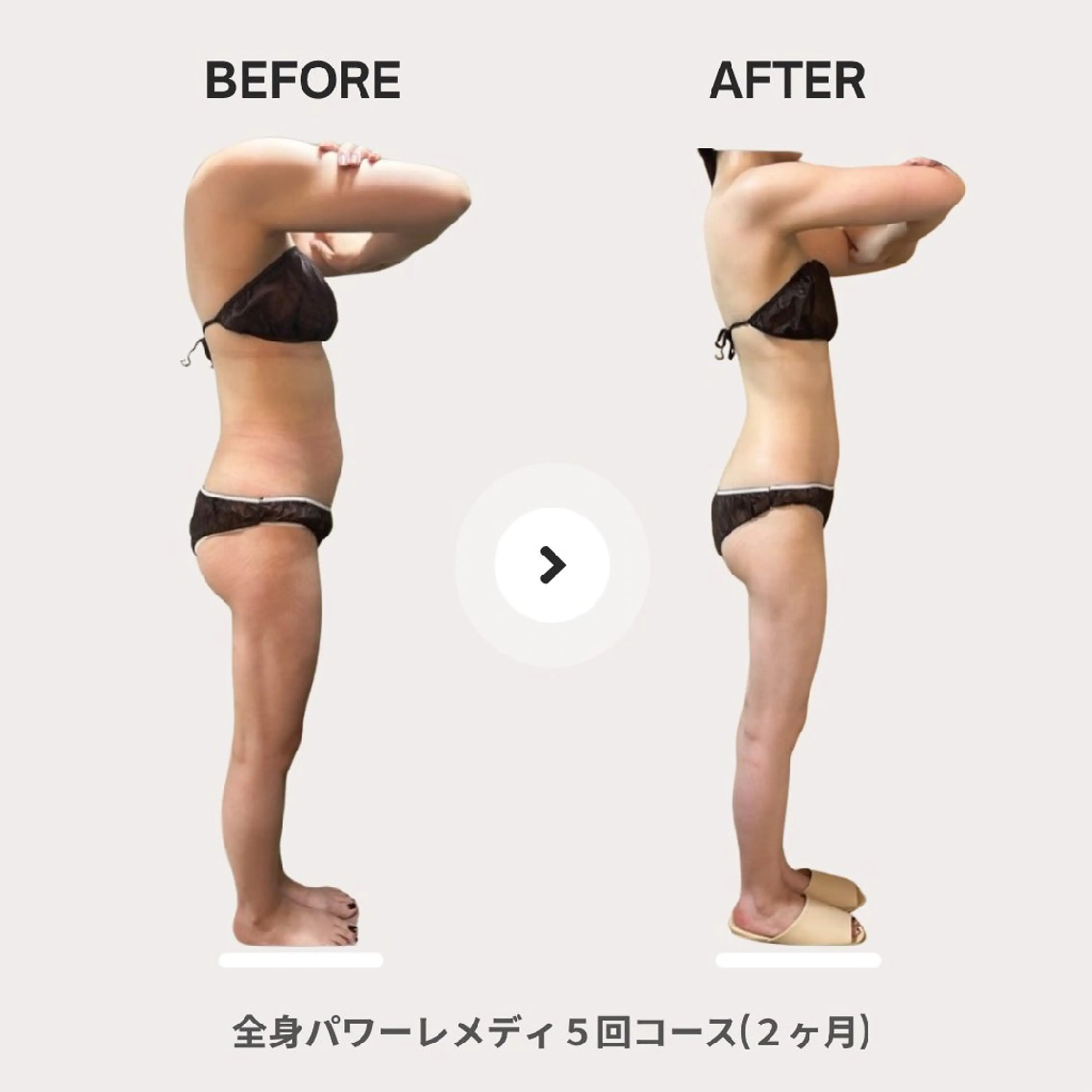 エステ リラク biloop所属・《痩身×疲労改善》 BILOOPのエステ・リラクイメージ