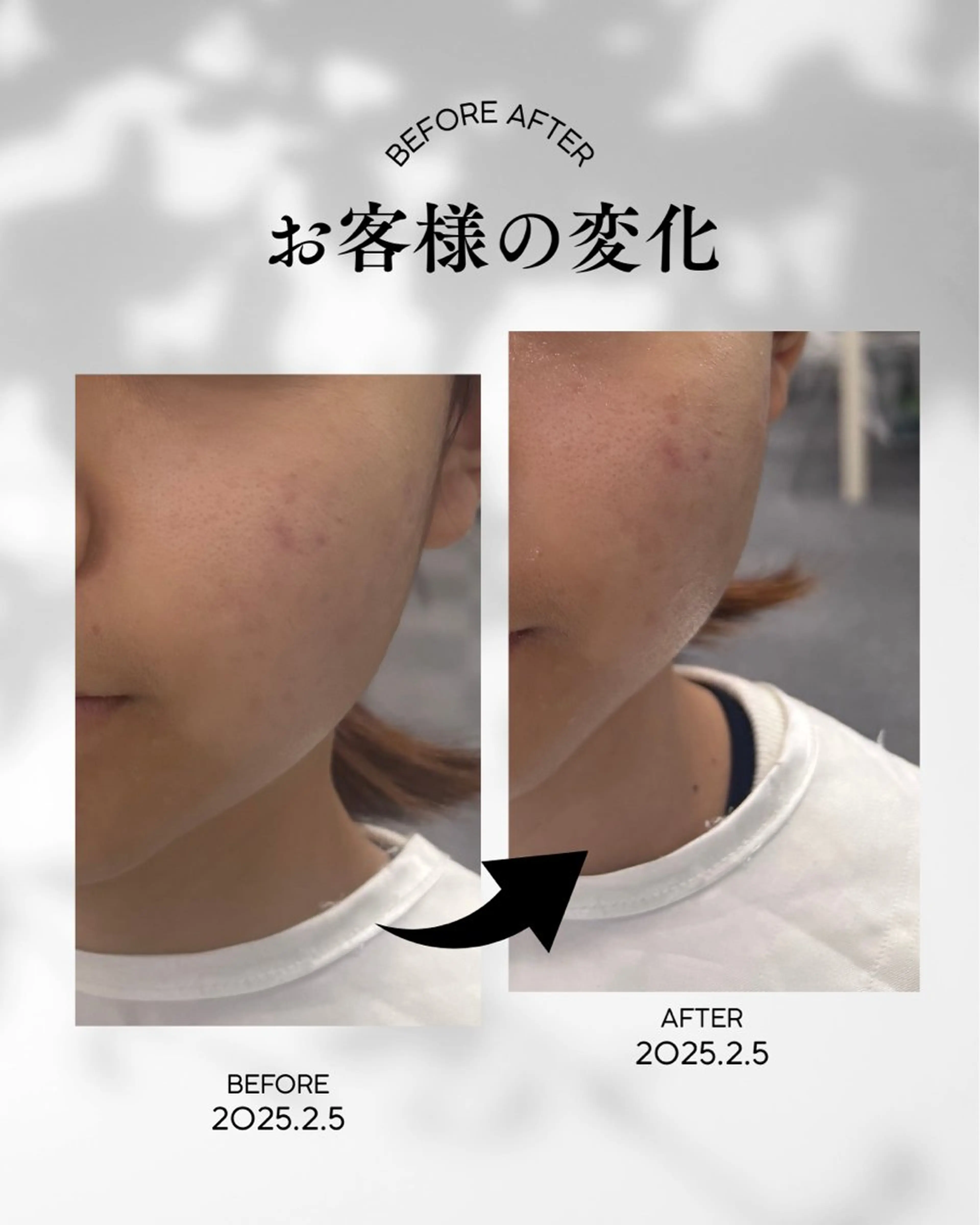 エステ skinLabo所属・saya Mのエステ・リラクイメージ