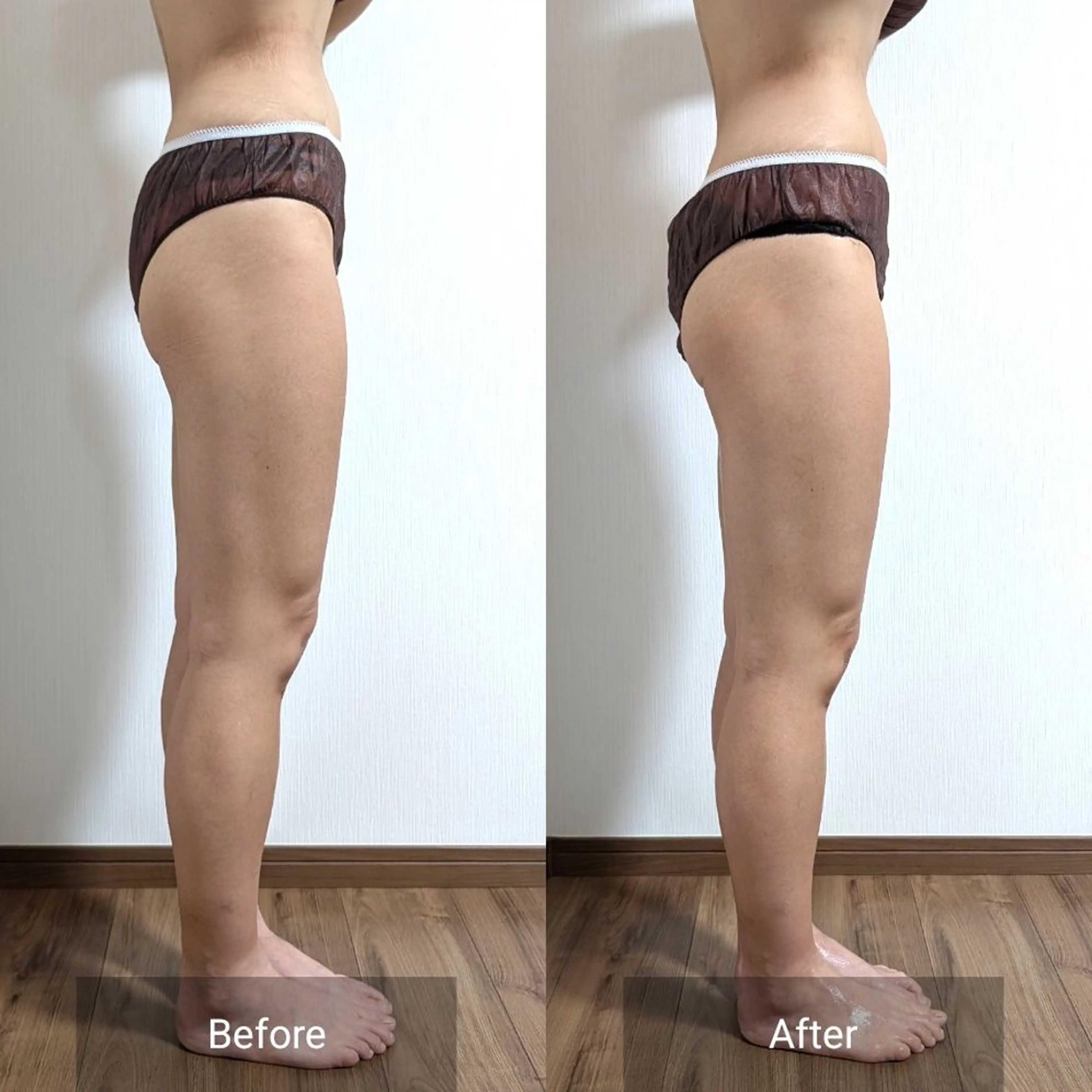 エステ nail RiRi アトレナチュラのエステ・リラクイメージ