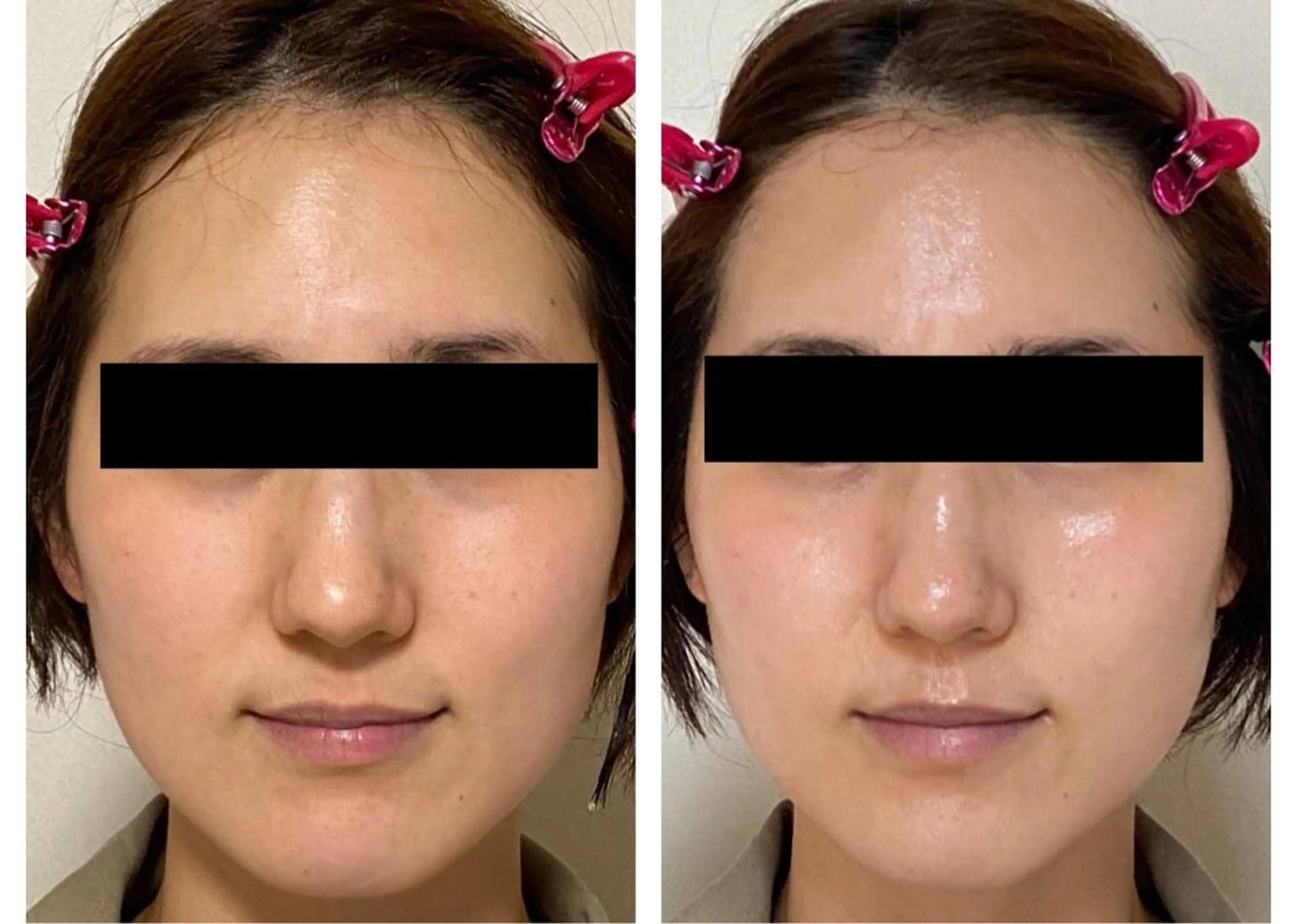 salon.plaisir（プレズィール）所属・酒井 瑠未のエステ・リラクイメージ