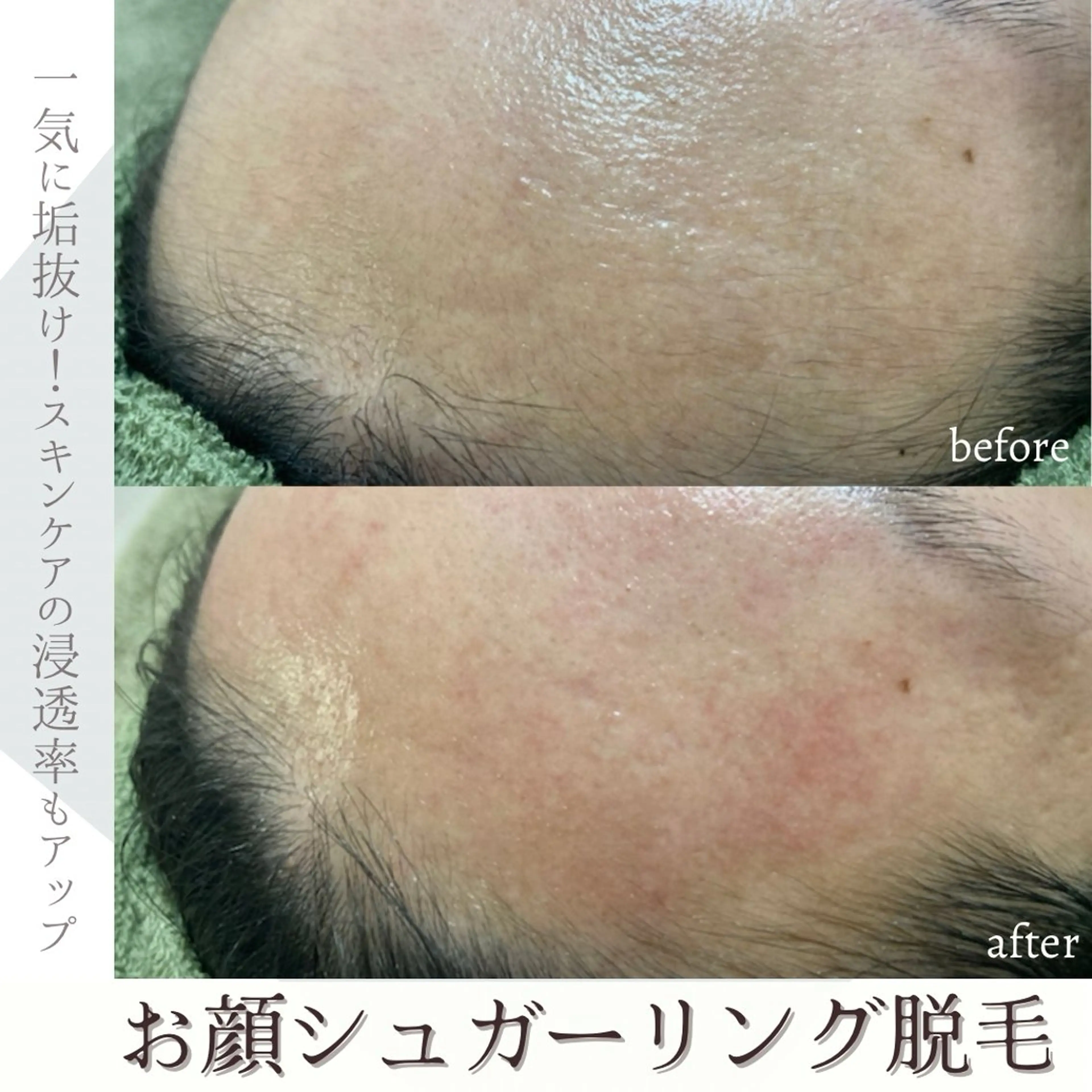 emirai 🌙AYANOのエステ・リラクイメージ