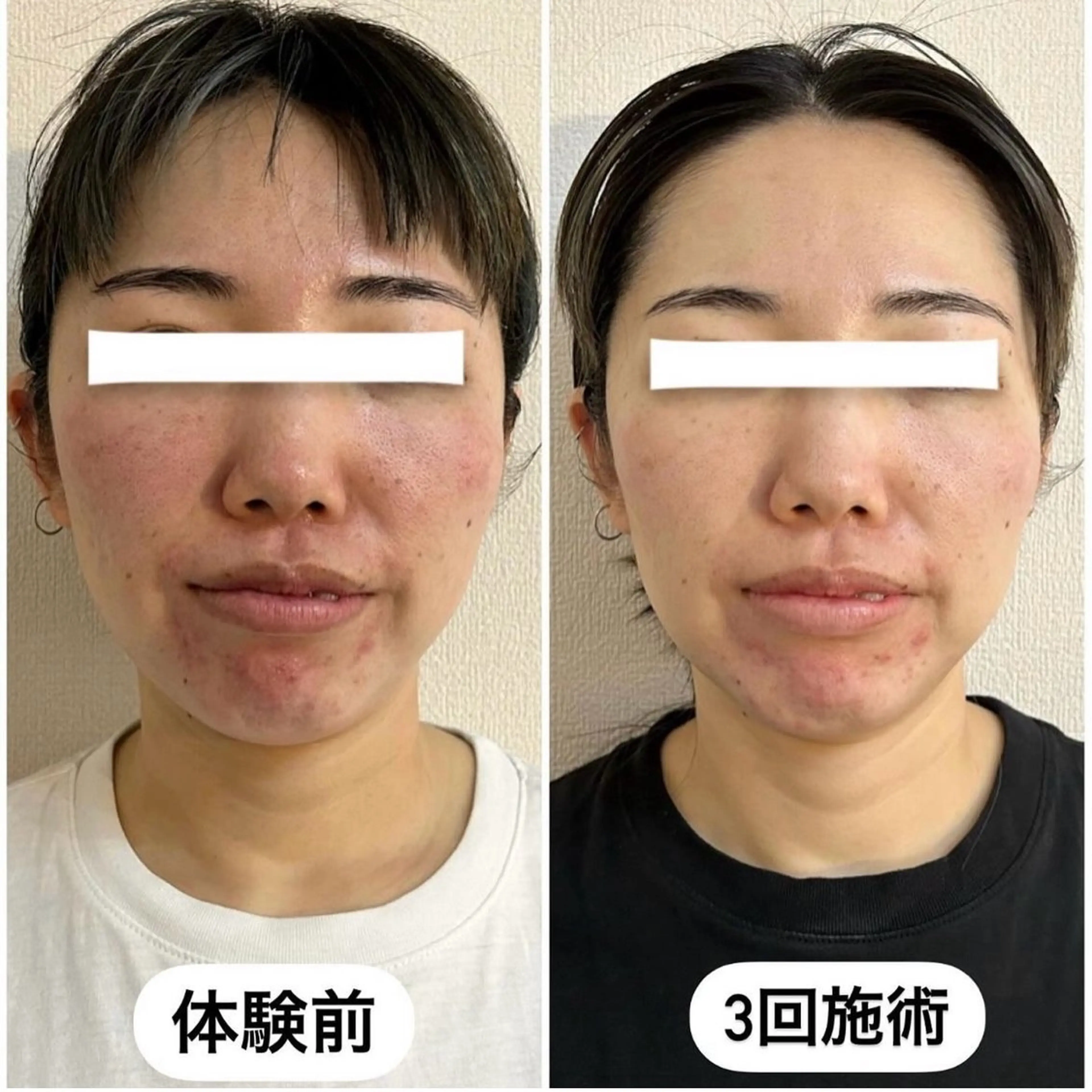 エステ ブライダルエステ&肌管理OGUMO所属・肌管理 OGUMOのエステ・リラクイメージ