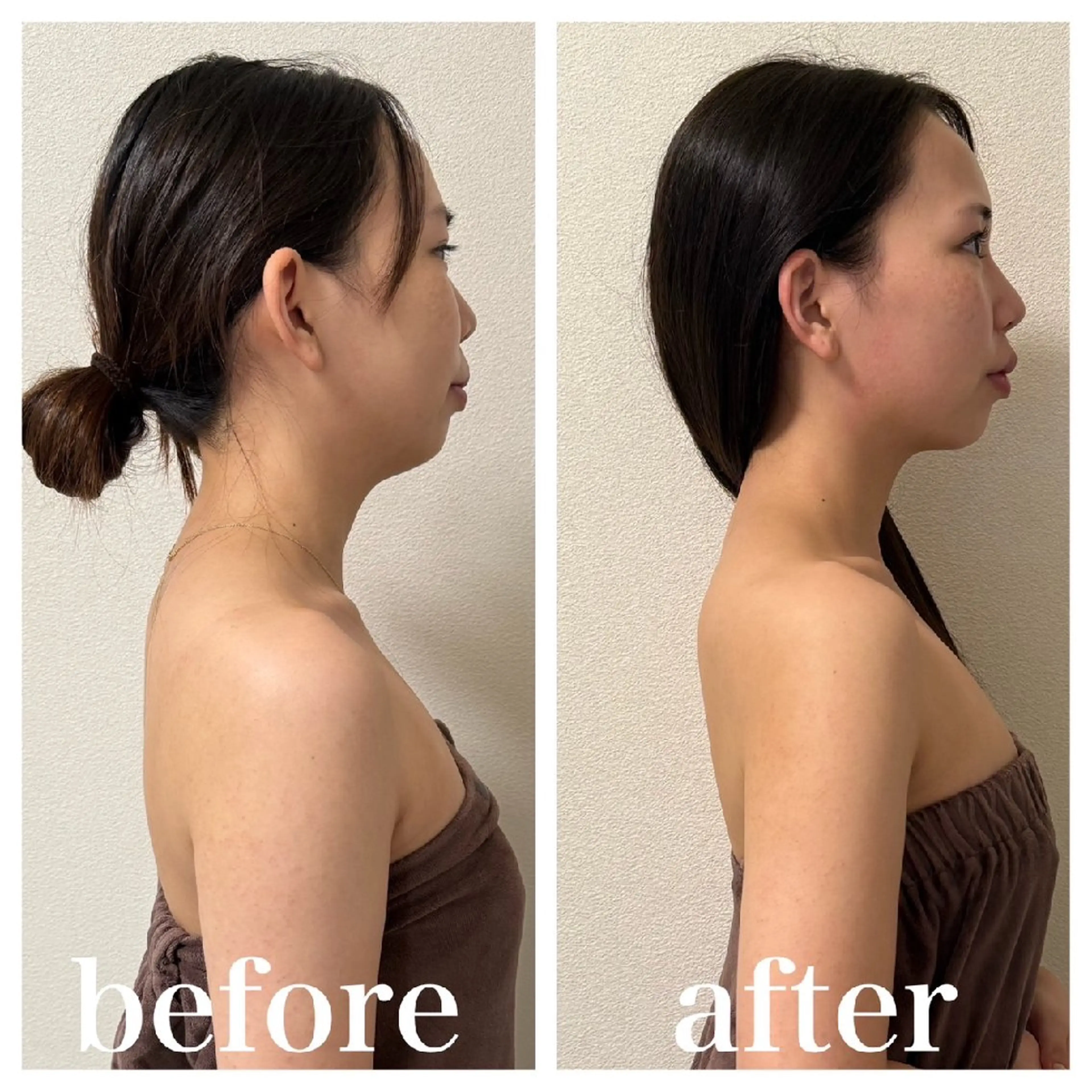 《ミニモ学割》整体×EMSバストアップ💆‍♀️の写真