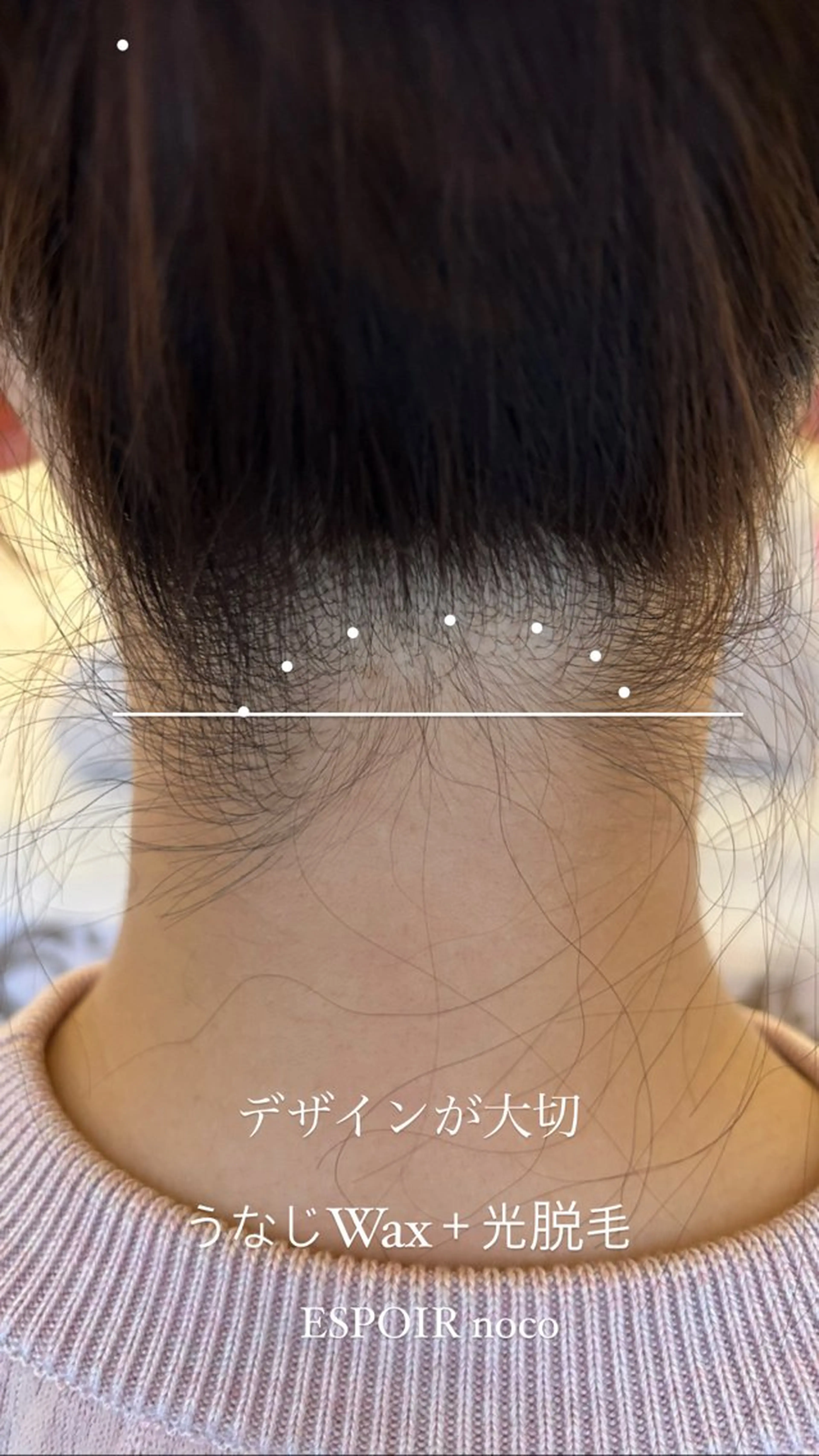 ワックス脱毛🌈 ESPOIRnocoのエステ・リラクイメージ