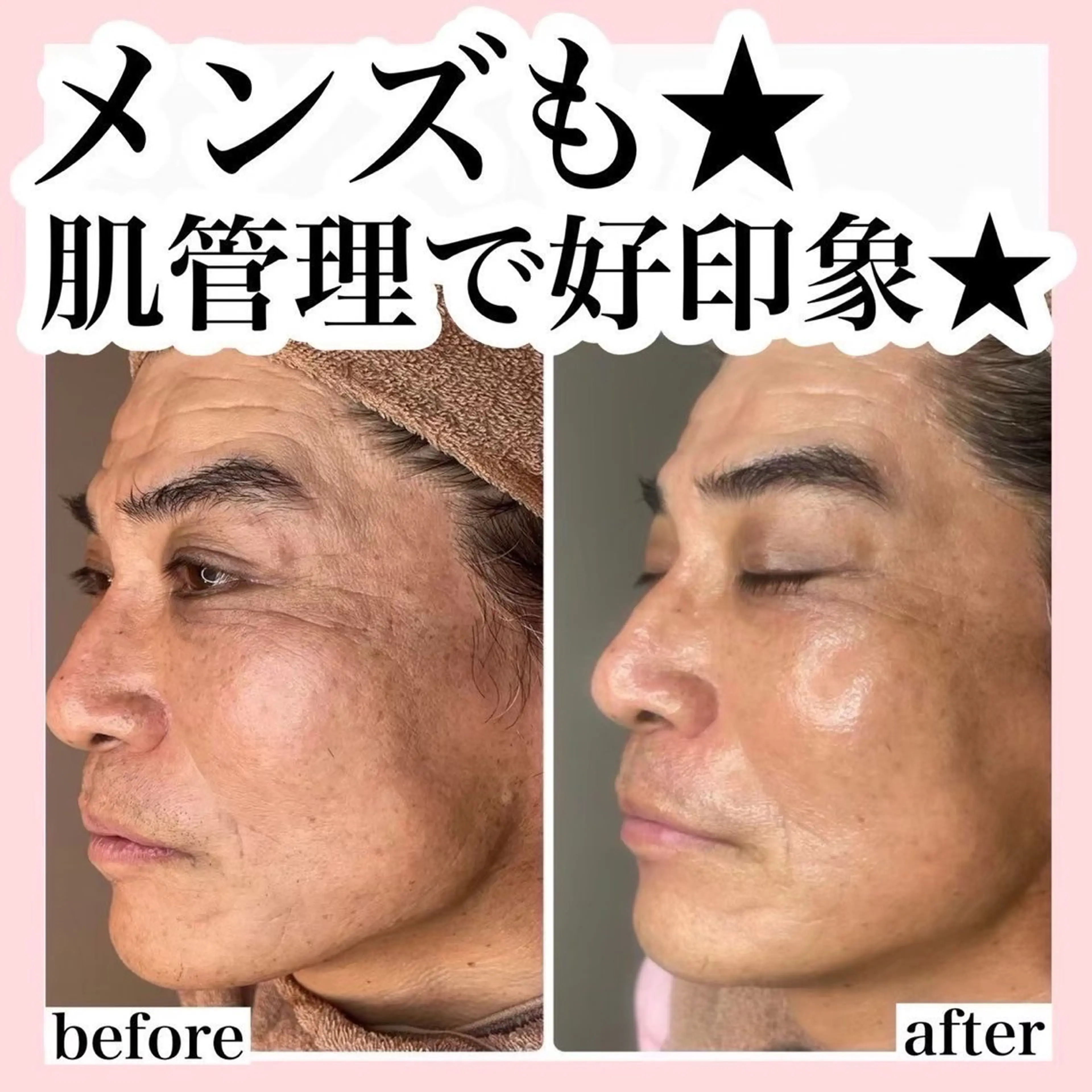 ハーブピーリング/ ララピール専門店のエステ・リラクイメージ