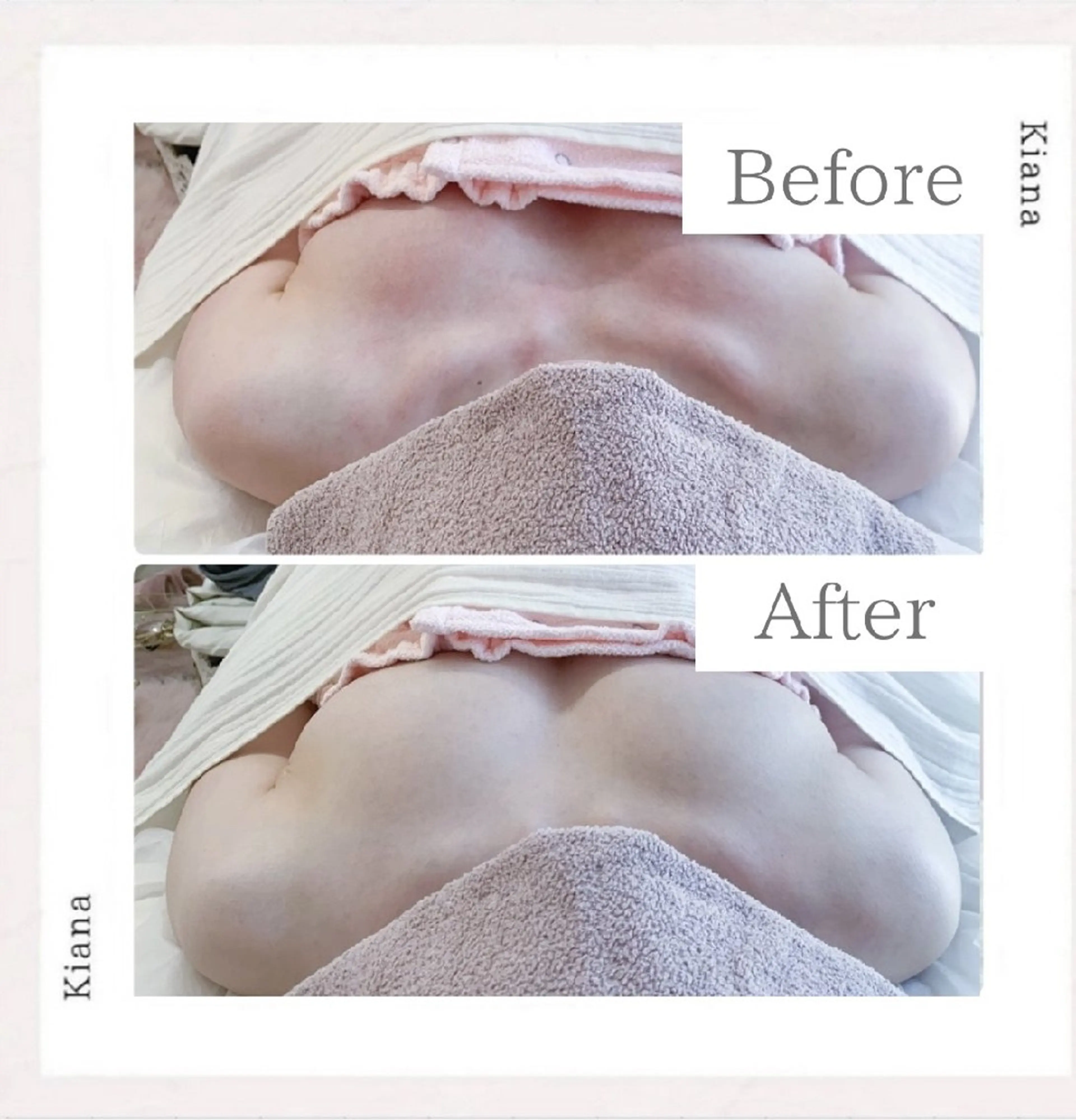 エステ リラク 【バスト専門店 】 Kiana のエステ・リラクイメージ