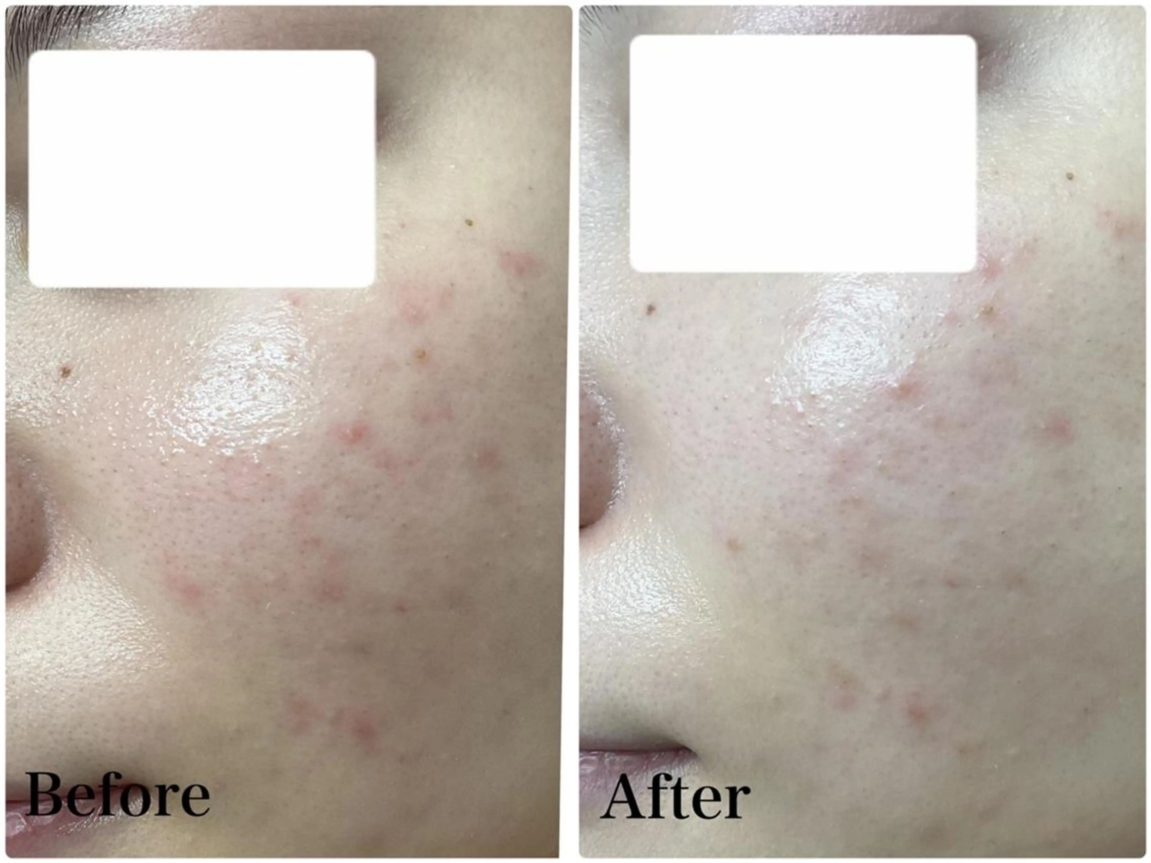 エステ パーソナルエステ L'purのエステ・リラクイメージ