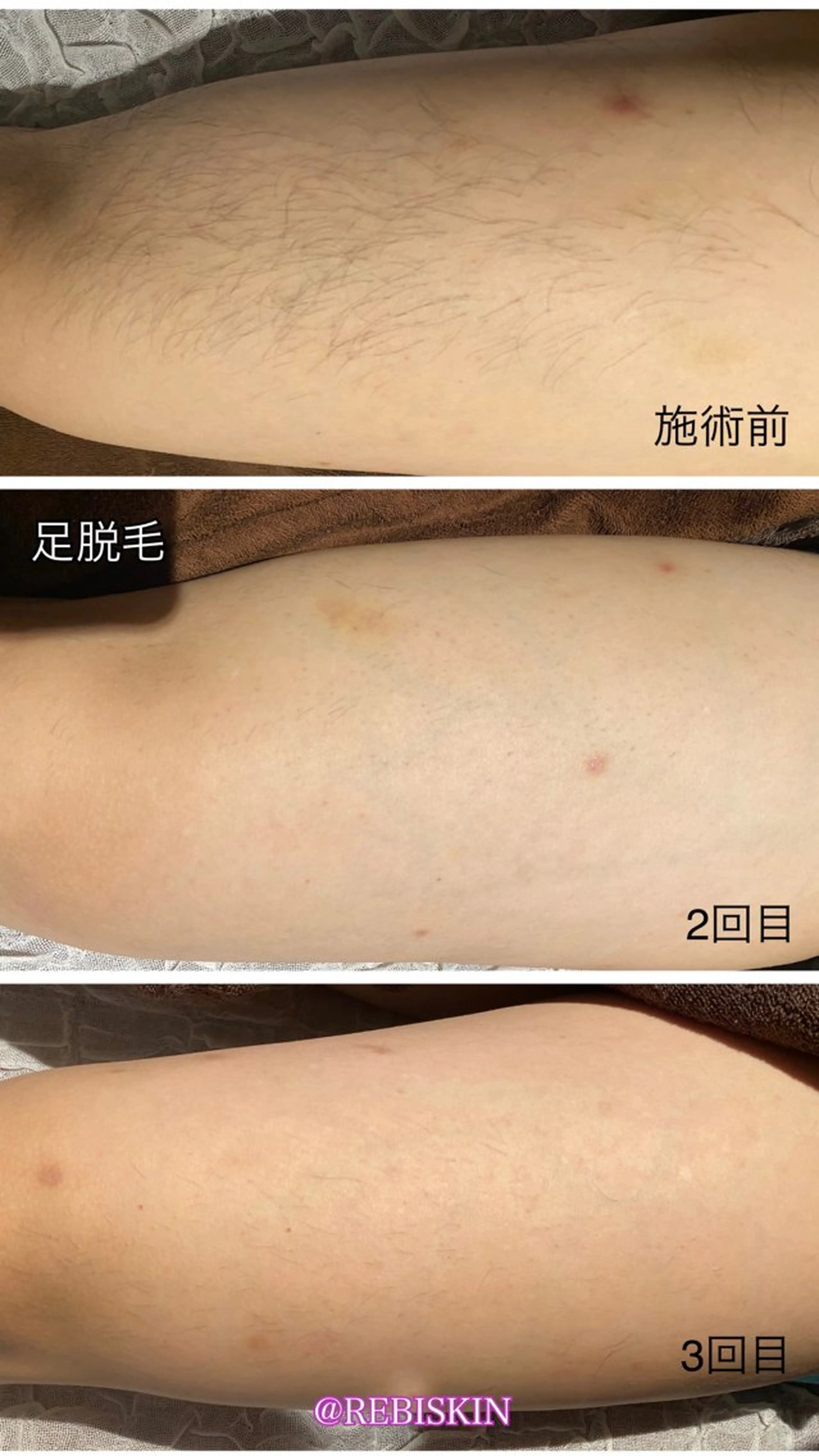 【痩身・脱毛サロン】 REBISKIN🌱のエステ・リラクイメージ