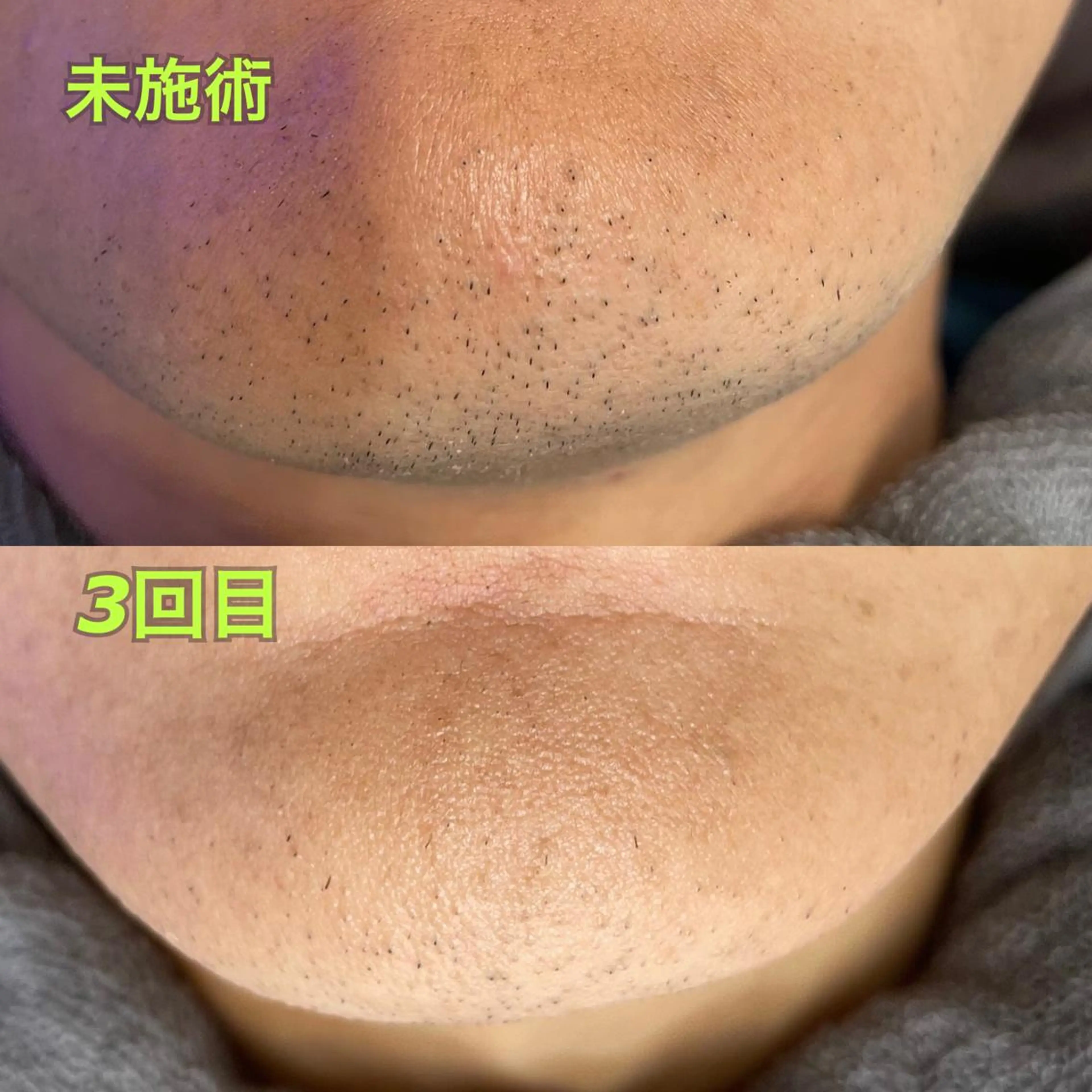 メンズ 脱毛 Luce所属・LUCE メンズ脱毛のエステ・リラクイメージ