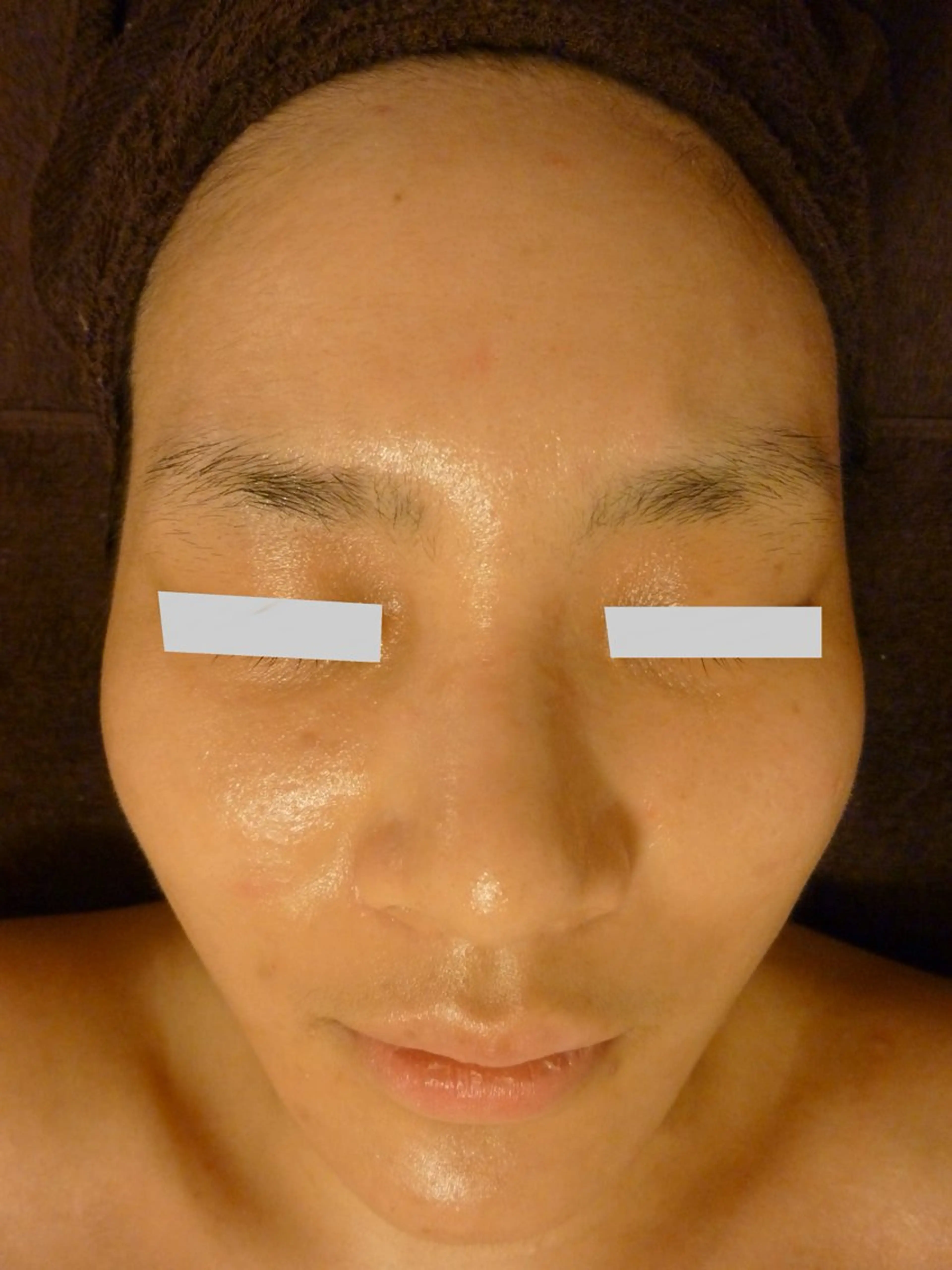 ピーリングサロン シャンテールのエステ・リラクイメージ