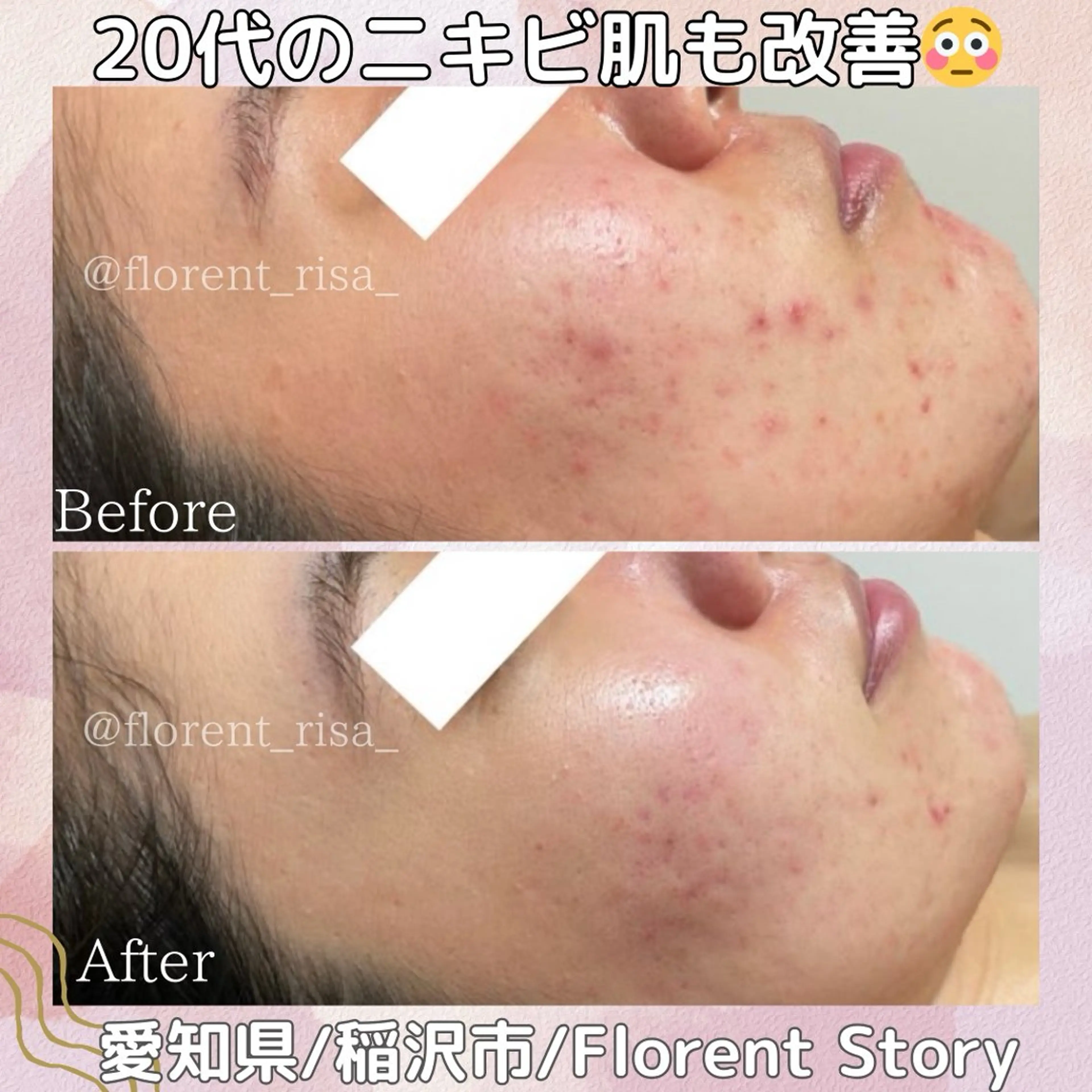 エステ 田中 里沙のエステ・リラクイメージ