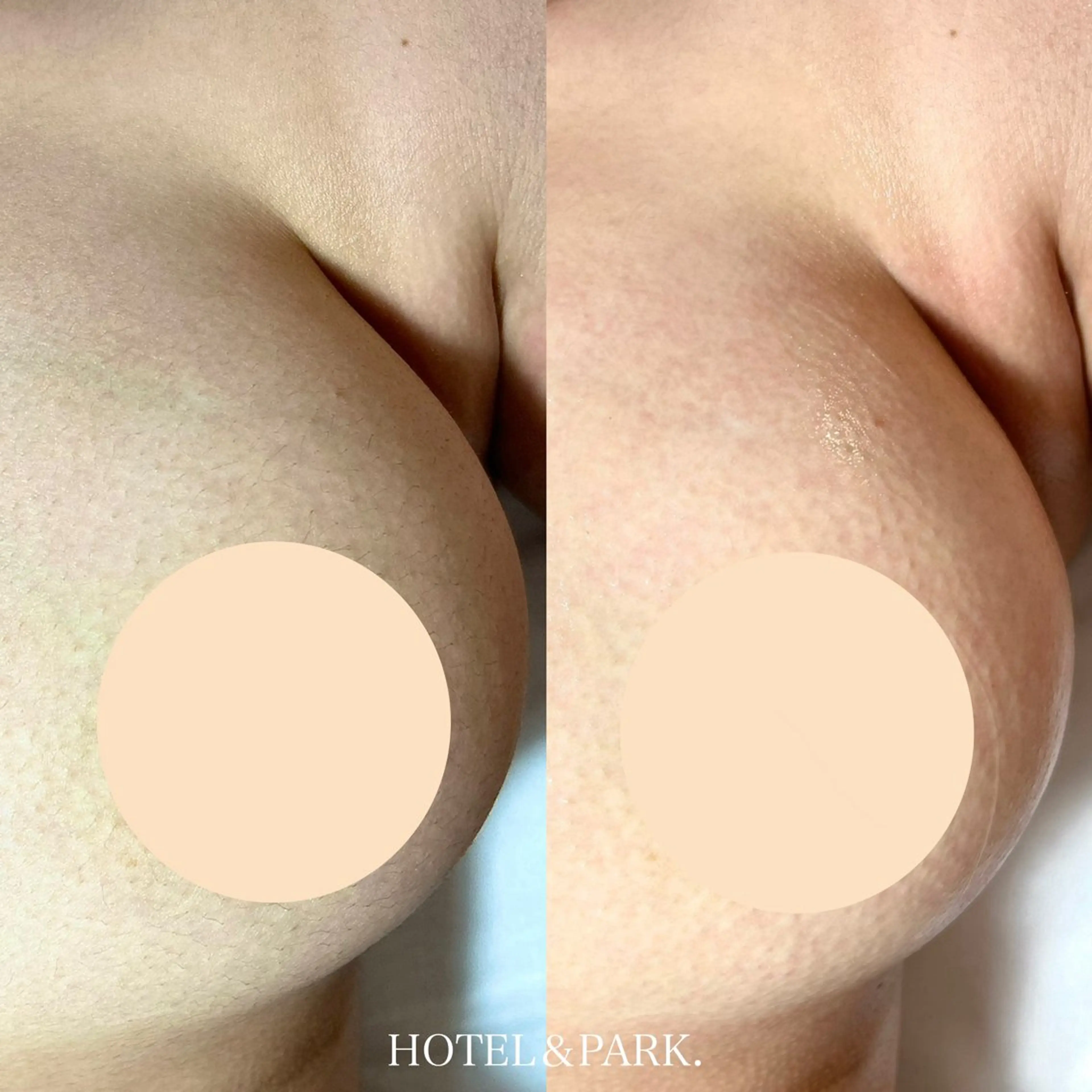 HOTEL&PARK .Moeワックス脱毛のエステ・リラクイメージ