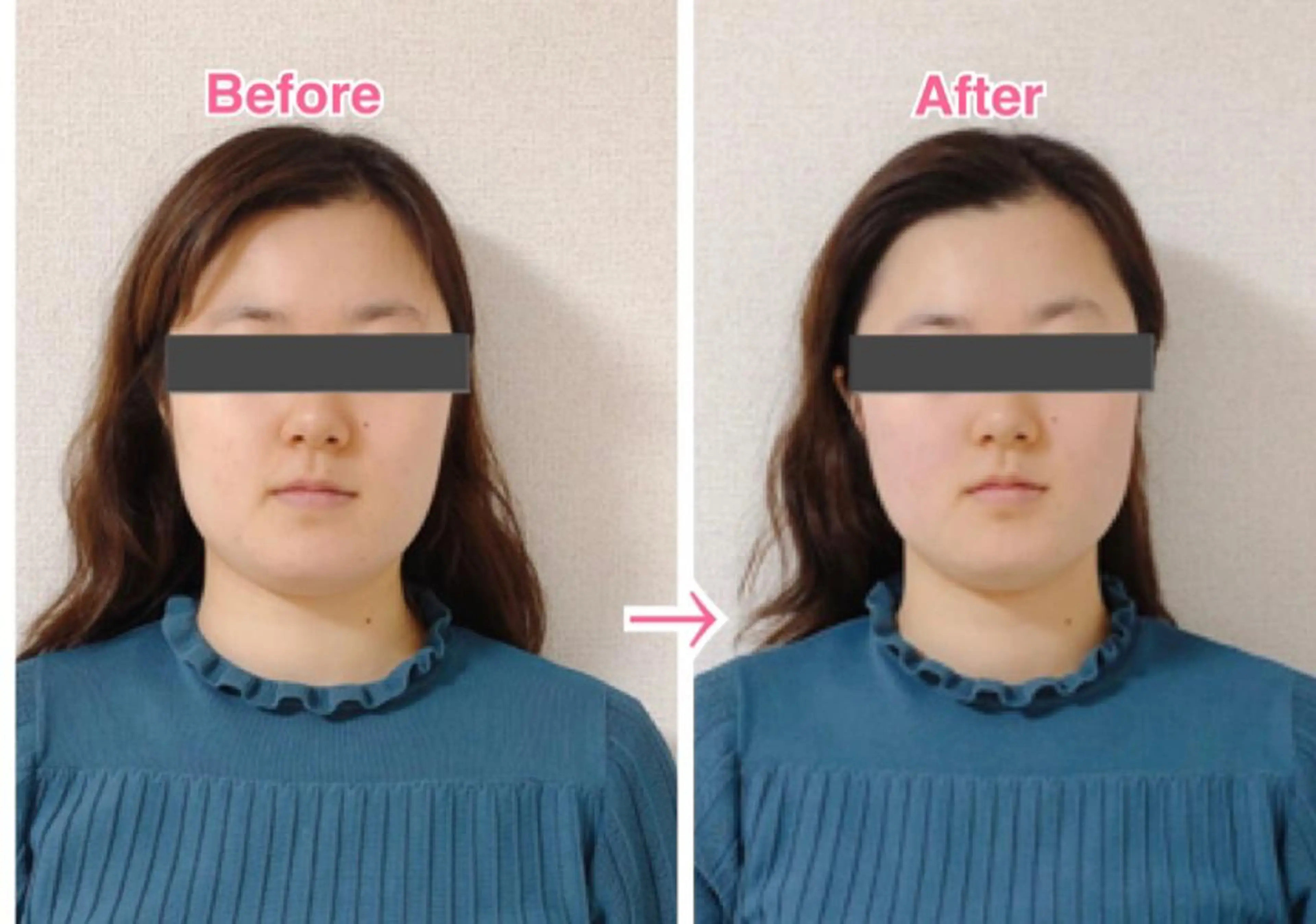 小顔・デトックスリンパ専門サロンRadiant Muse (ラディアントミューズ)所属・小顔・たるみ改善 ラディアントミューズのエステ・リラクイメージ