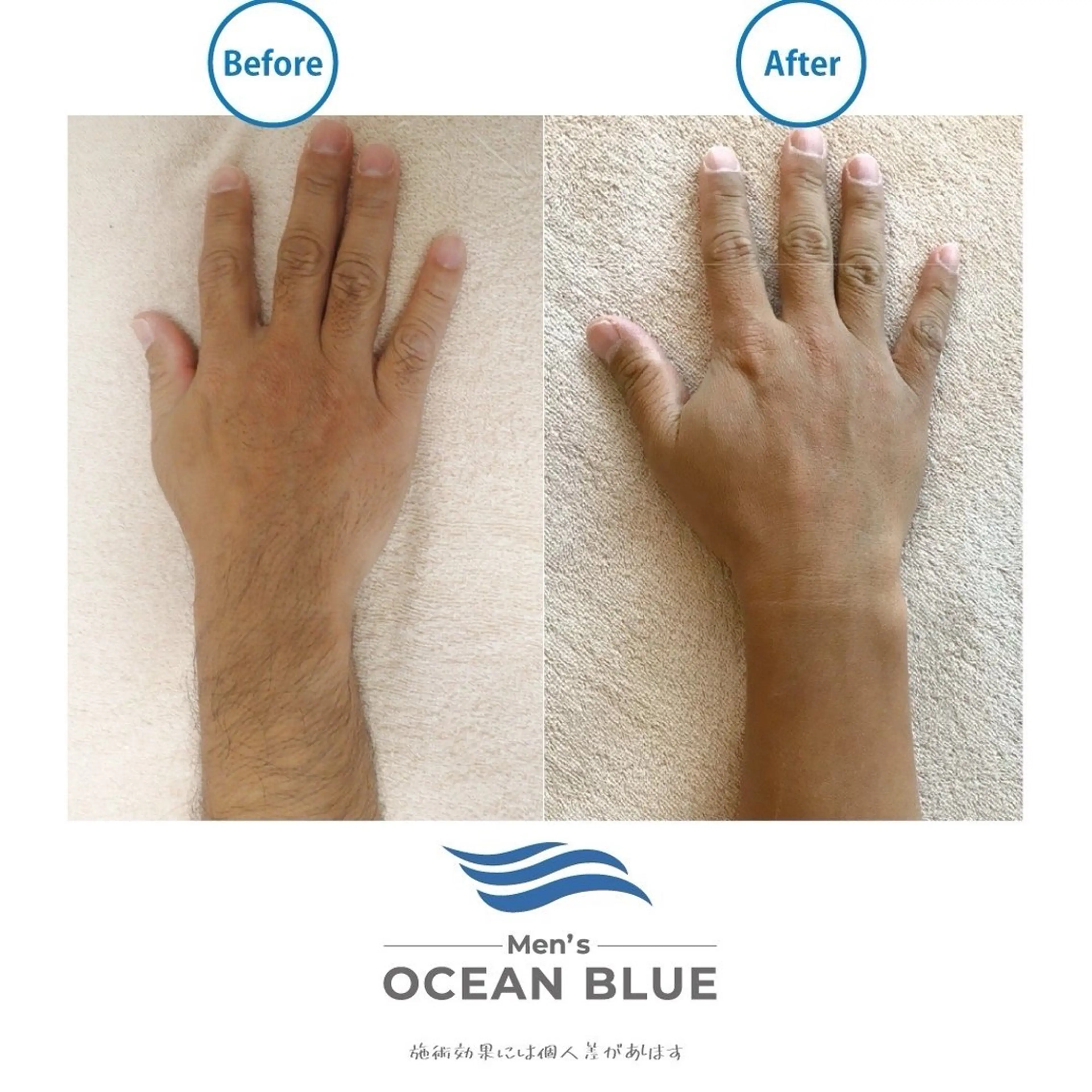 メンズ メンズオーシャンブルー福岡店所属・柿添 希実のエステ・リラクイメージ